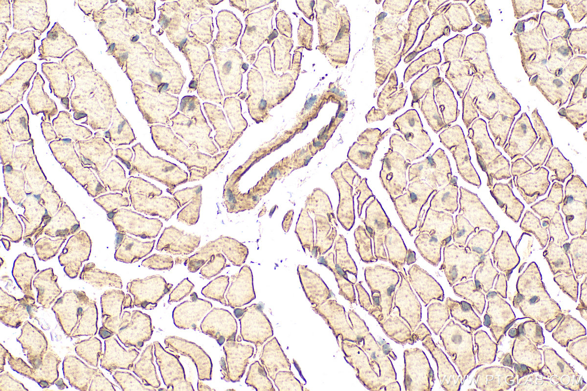 Immunohistochemistry (IHC) staining of mouse heart tissue using Cadherin-13 Polyclonal antibody (12618-1-AP)