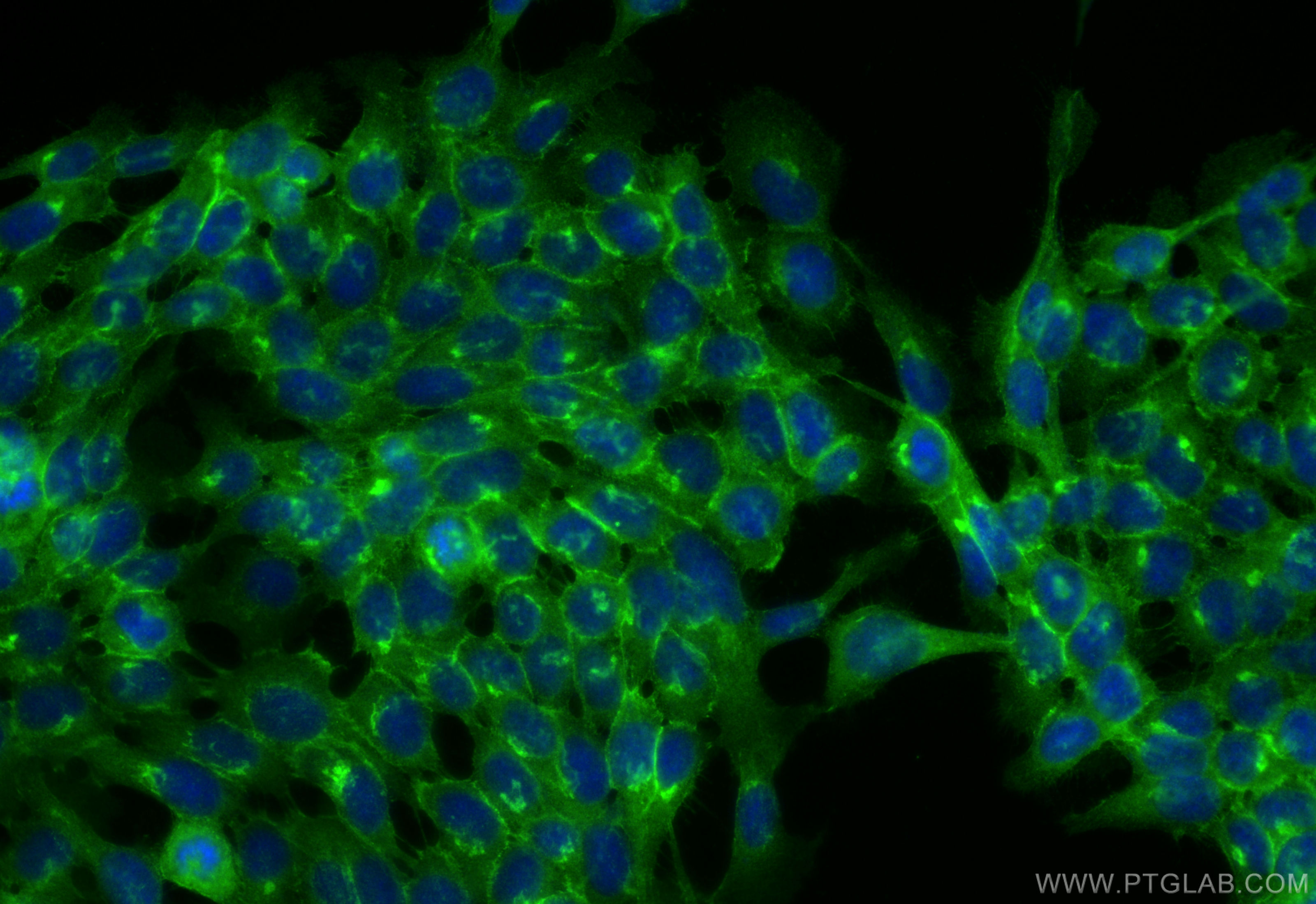 Immunofluorescence (IF) / fluorescent staining of A431 cells using P-cadherin Polyclonal antibody (13773-1-AP)