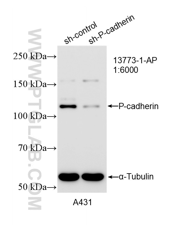 Western Blot (WB) analysis of A431 cells using P-cadherin Polyclonal antibody (13773-1-AP)