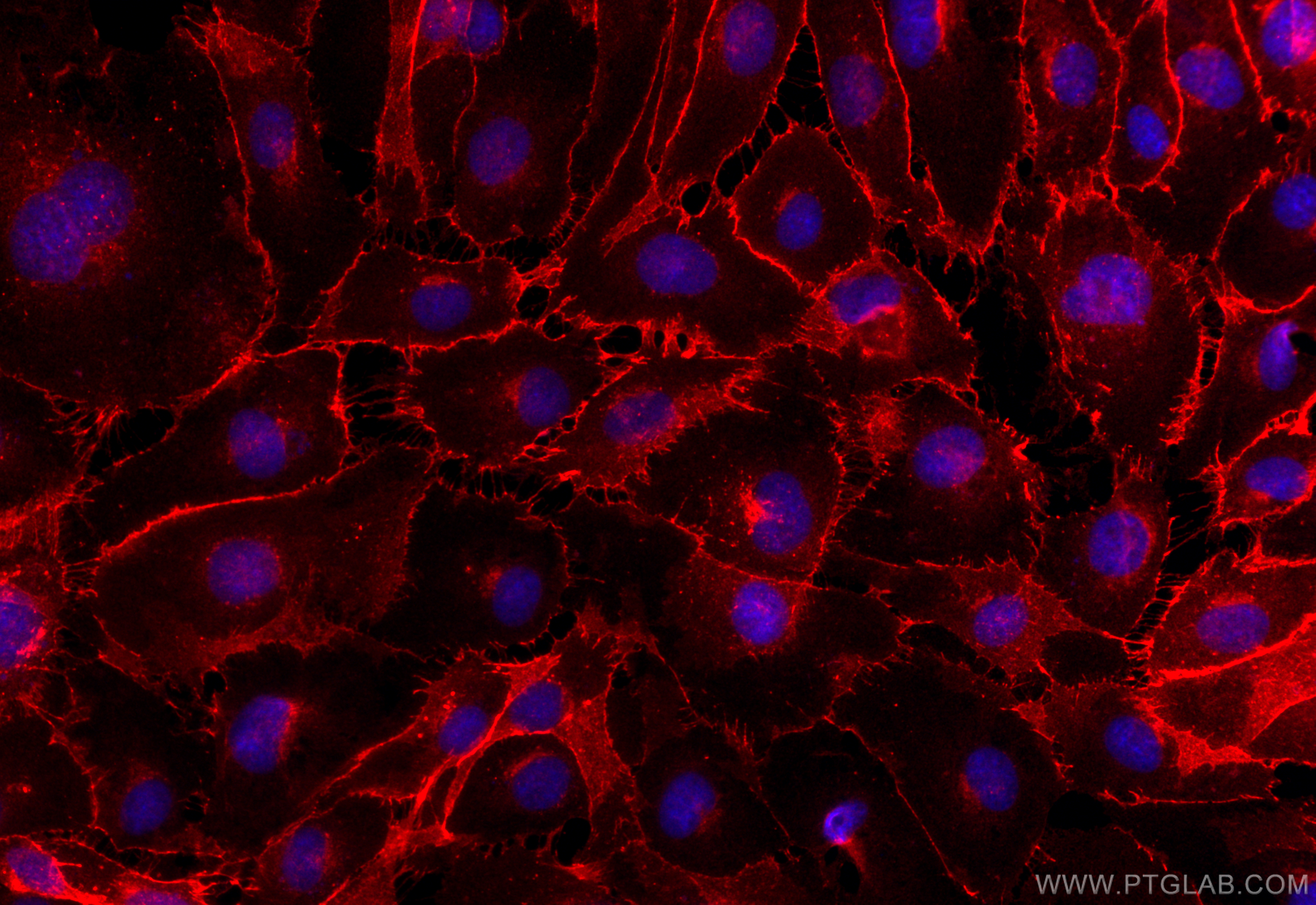 Immunofluorescence (IF) / fluorescent staining of HUVEC cells using VE-cadherin/CD144 Polyclonal antibody (27956-1-AP)