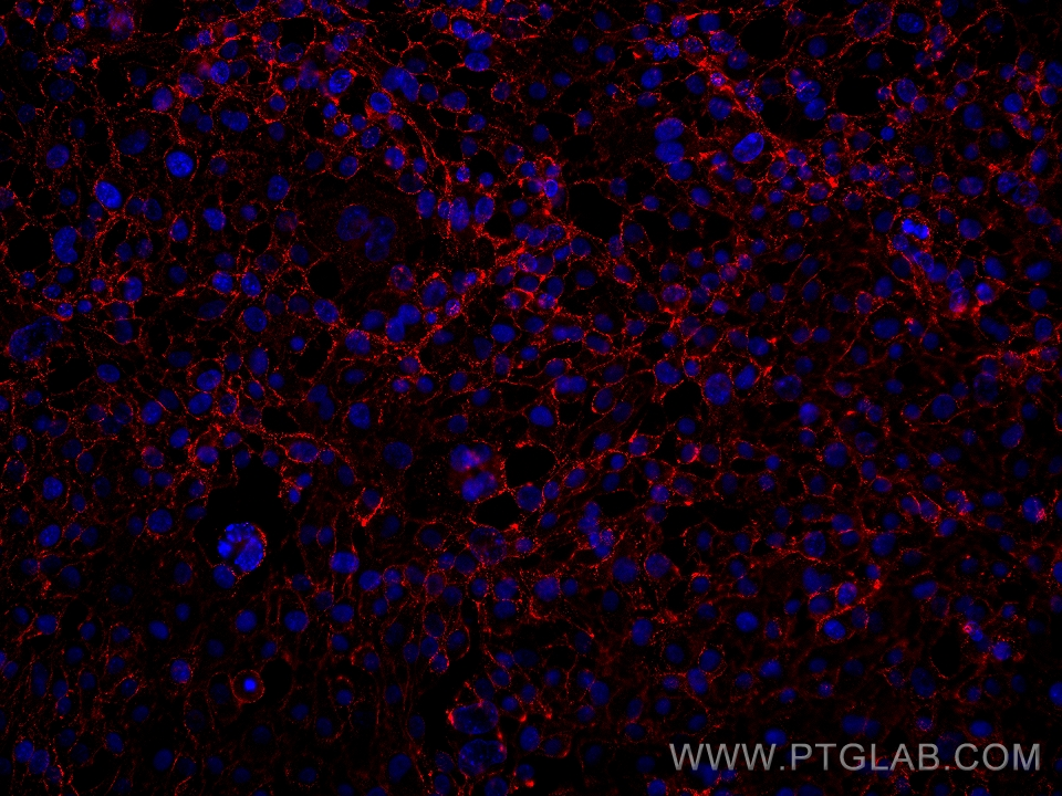 Immunofluorescence (IF) / fluorescent staining of HUVEC cells using VE-cadherin/CD144 Monoclonal antibody (66804-1-Ig)