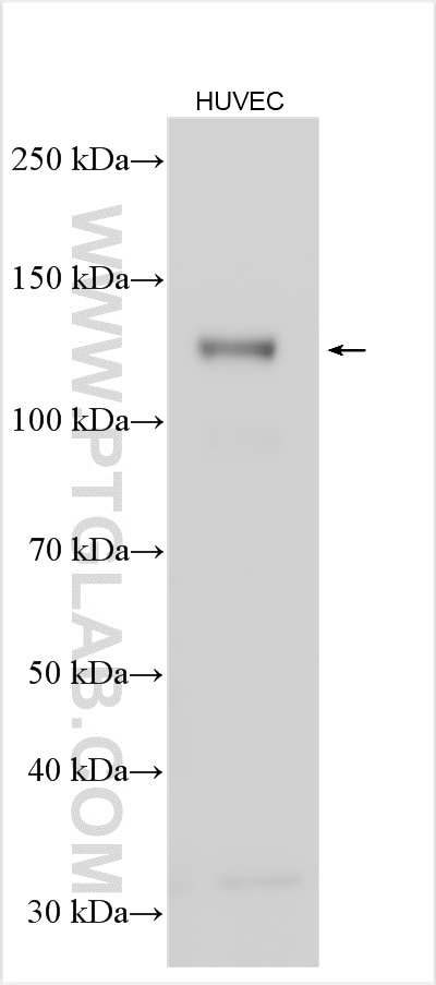 Western Blot (WB) analysis of various lysates using VE-cadherin/CD144 Monoclonal antibody (66804-1-Ig)