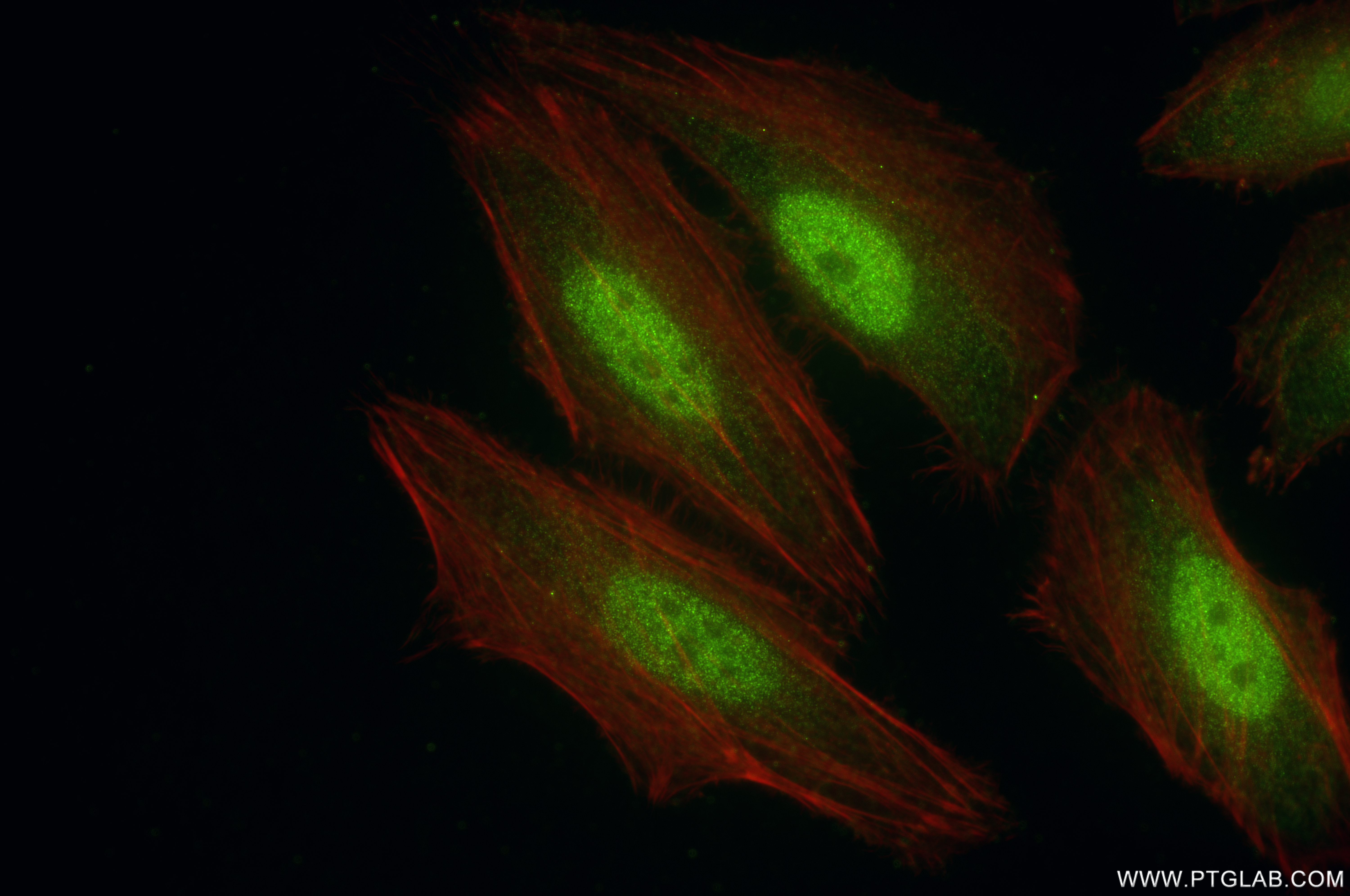 Immunofluorescence (IF) / fluorescent staining of HeLa cells using CDK1 Recombinant antibody (84271-1-RR)