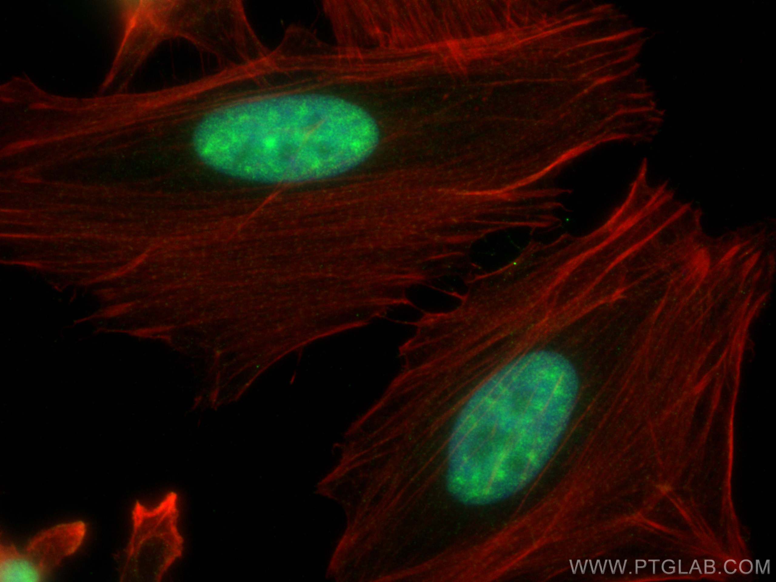 Immunofluorescence (IF) / fluorescent staining of HeLa cells using CDK13 Polyclonal antibody (30461-1-AP)