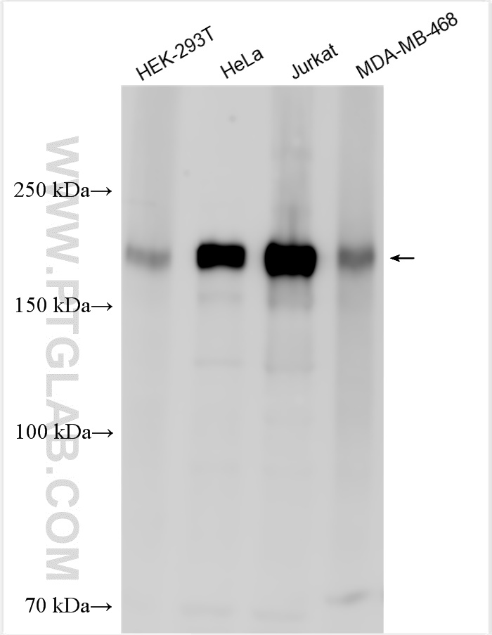 Western Blot (WB) analysis of various lysates using CDK13 Polyclonal antibody (30461-1-AP)