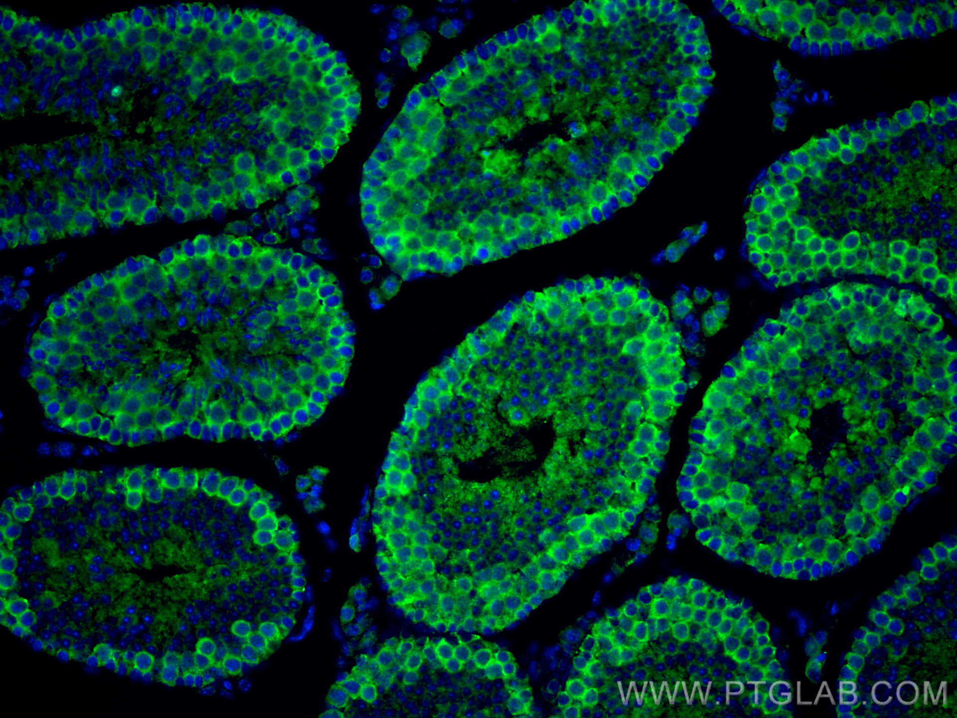 Immunofluorescence (IF) / fluorescent staining of mouse testis tissue using CDK2 Polyclonal antibody (10122-1-AP)