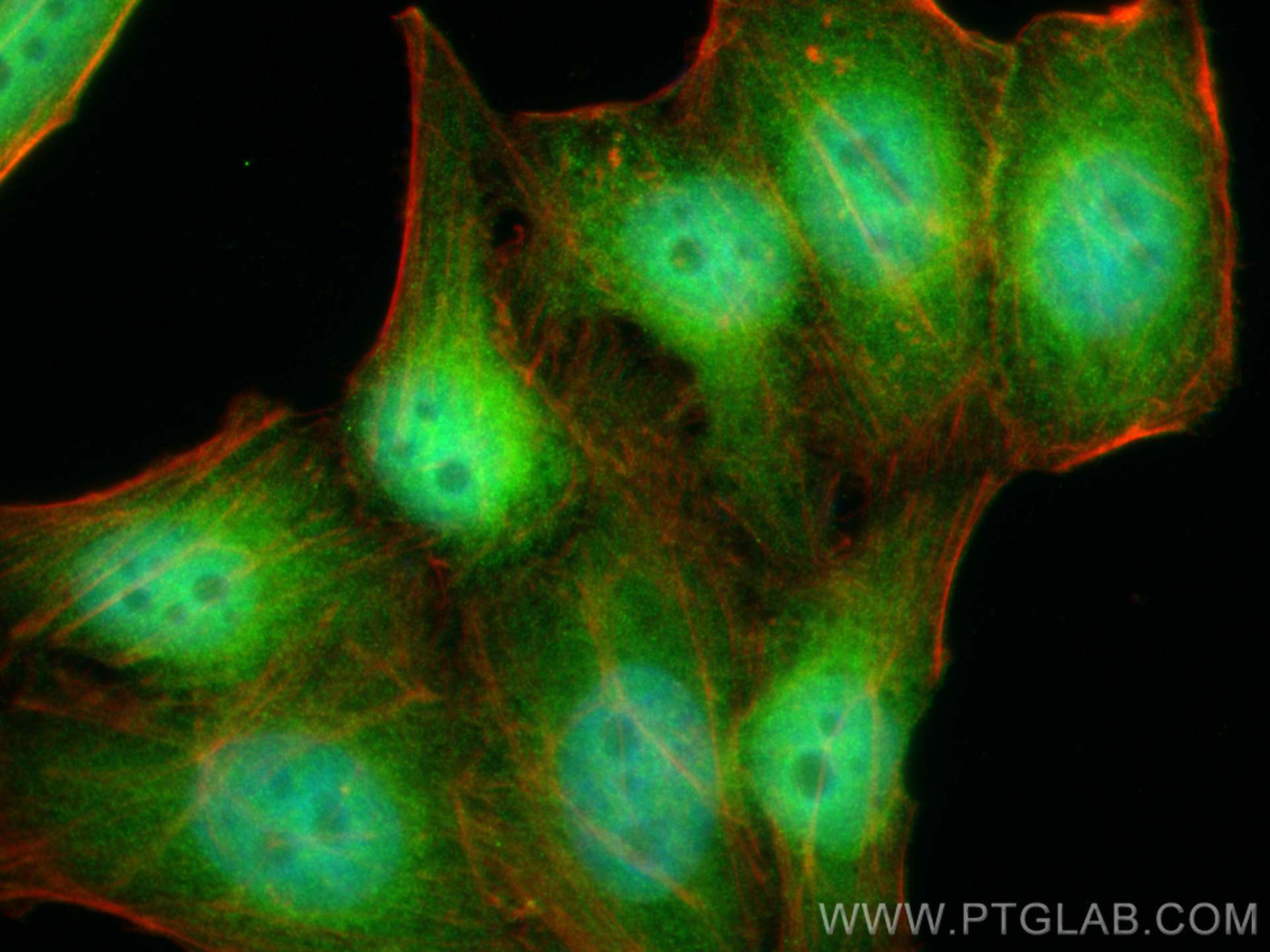 Immunofluorescence (IF) / fluorescent staining of HepG2 cells using CDK2 Polyclonal antibody (10122-1-AP)