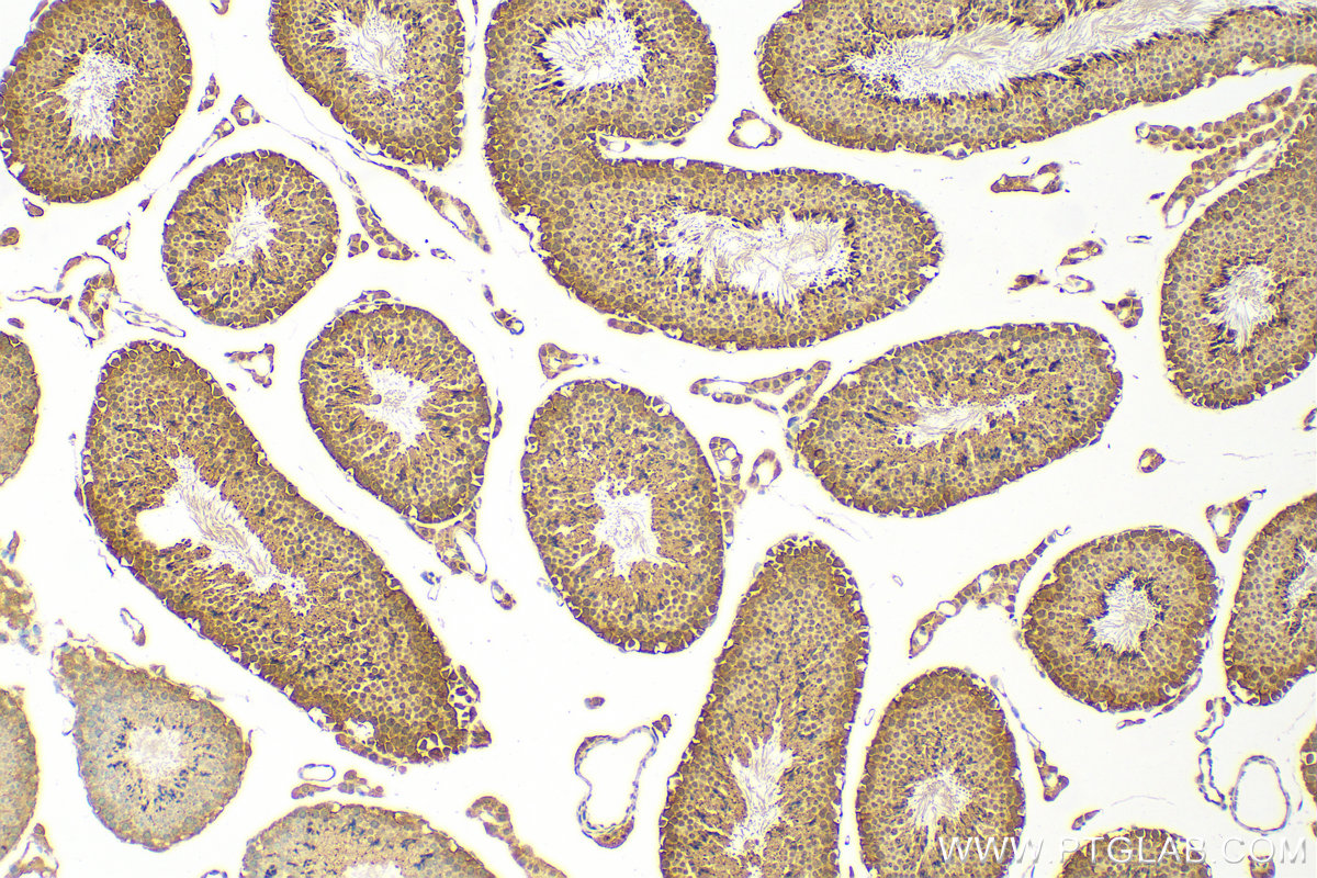 Immunohistochemistry (IHC) staining of mouse testis tissue using CDK2 Polyclonal antibody (10122-1-AP)