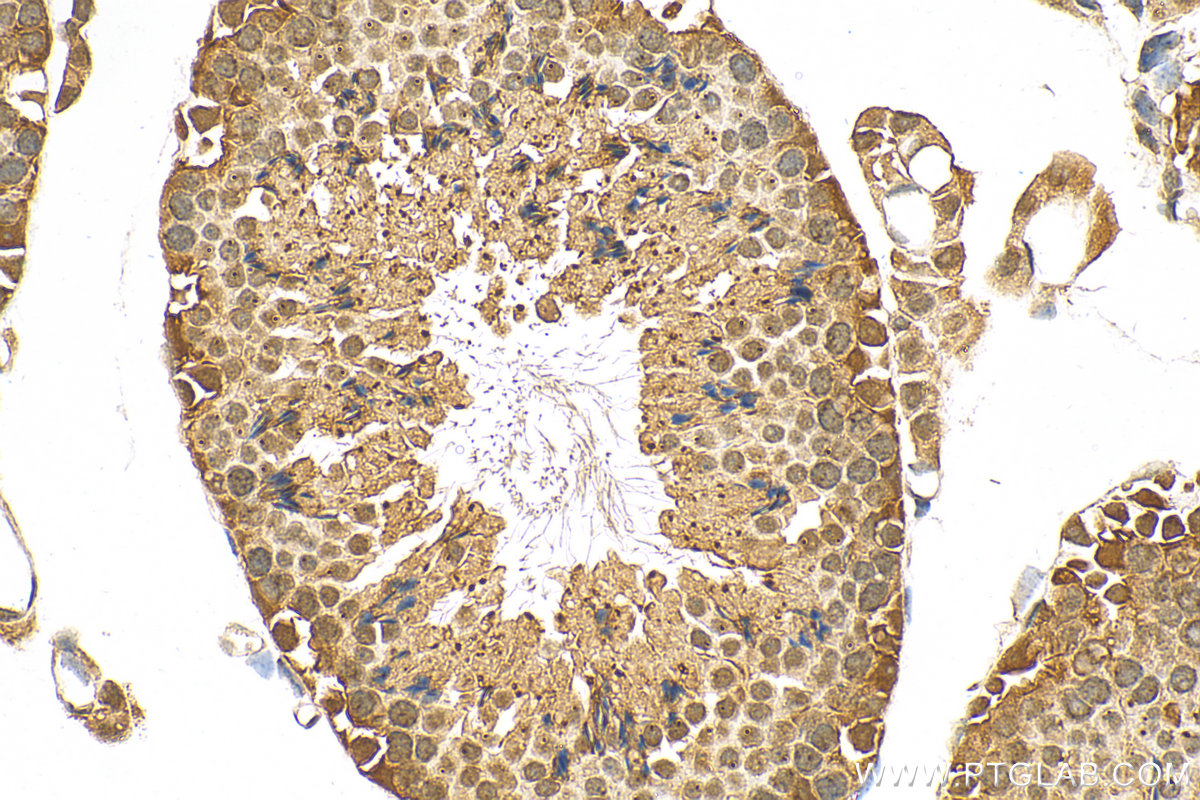 Immunohistochemistry (IHC) staining of mouse testis tissue using CDK2 Polyclonal antibody (10122-1-AP)