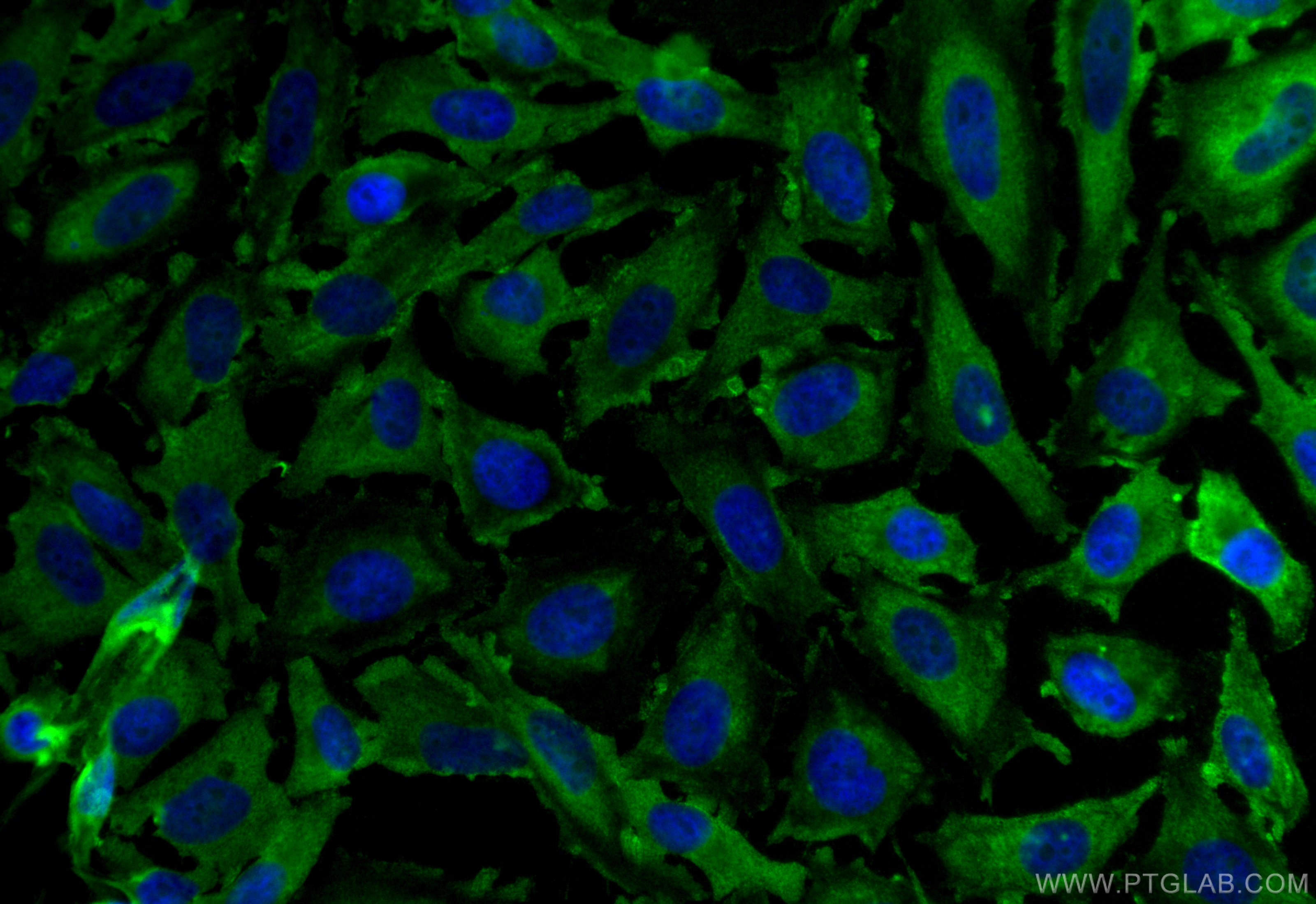 Immunofluorescence (IF) / fluorescent staining of HeLa cells using CDK2 Monoclonal antibody (60312-1-Ig)