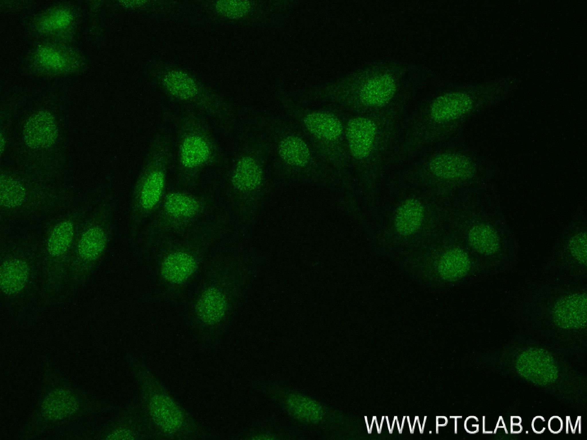 Immunofluorescence (IF) / fluorescent staining of HepG2 cells using CDK2 Recombinant antibody (83635-2-RR)