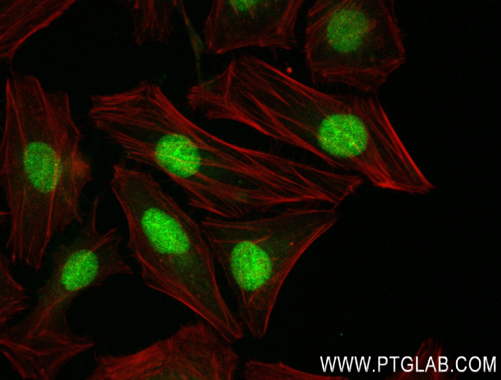 Immunofluorescence (IF) / fluorescent staining of HeLa cells using CDK2 Recombinant antibody (83635-5-RR)