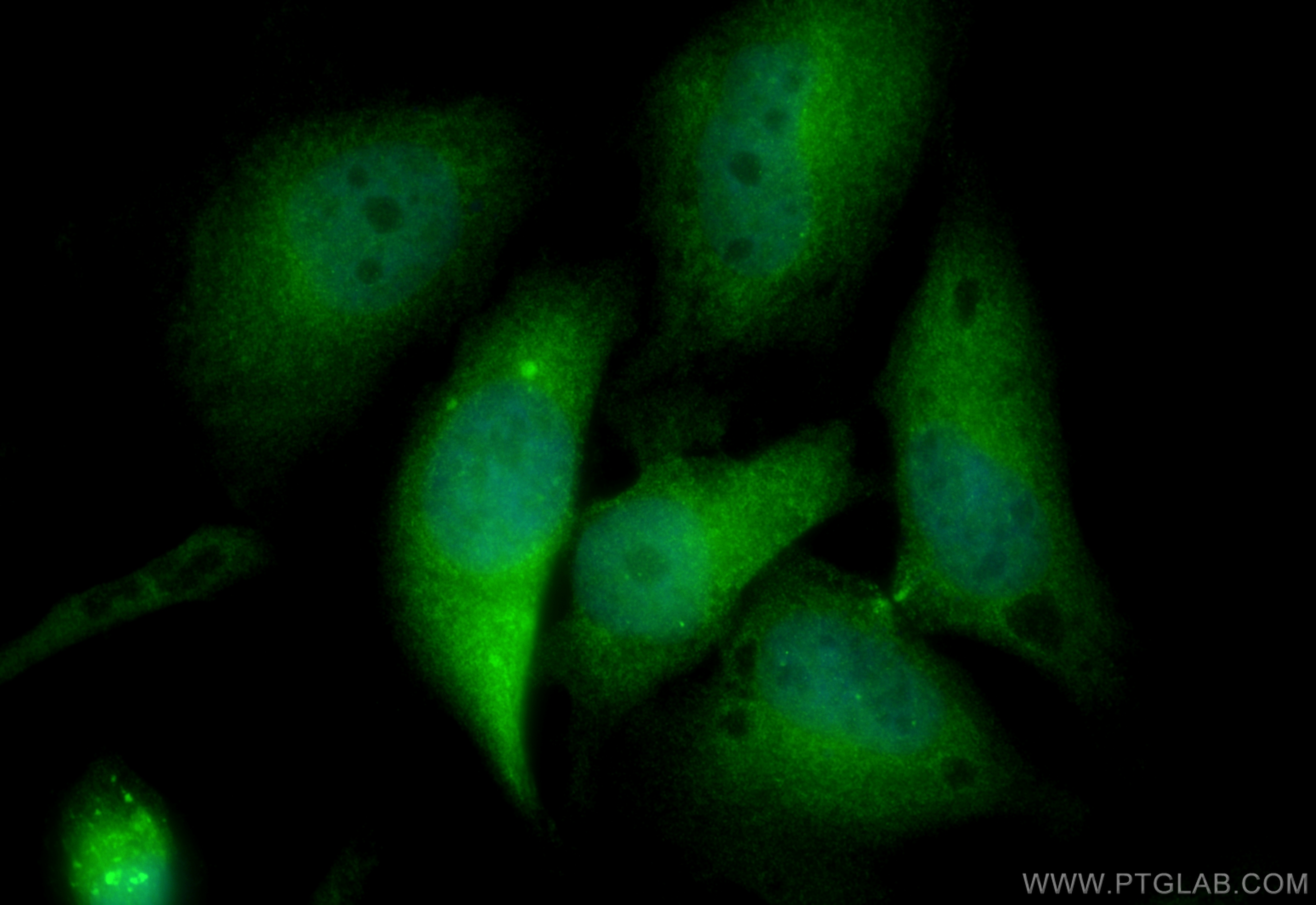 Immunofluorescence (IF) / fluorescent staining of HeLa cells using CDK3 Polyclonal antibody (55103-1-AP)