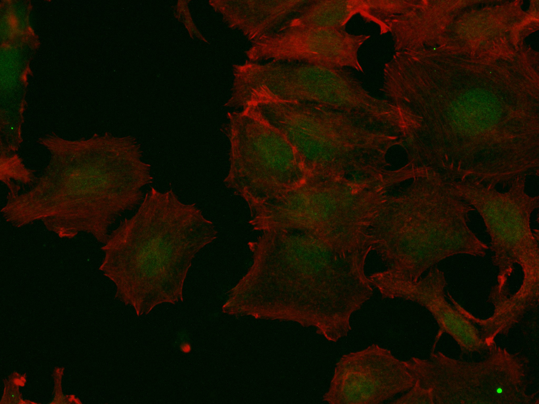 Immunofluorescence (IF) / fluorescent staining of MCF-7 cells using CDK4 Recombinant antibody (83994-3-RR)