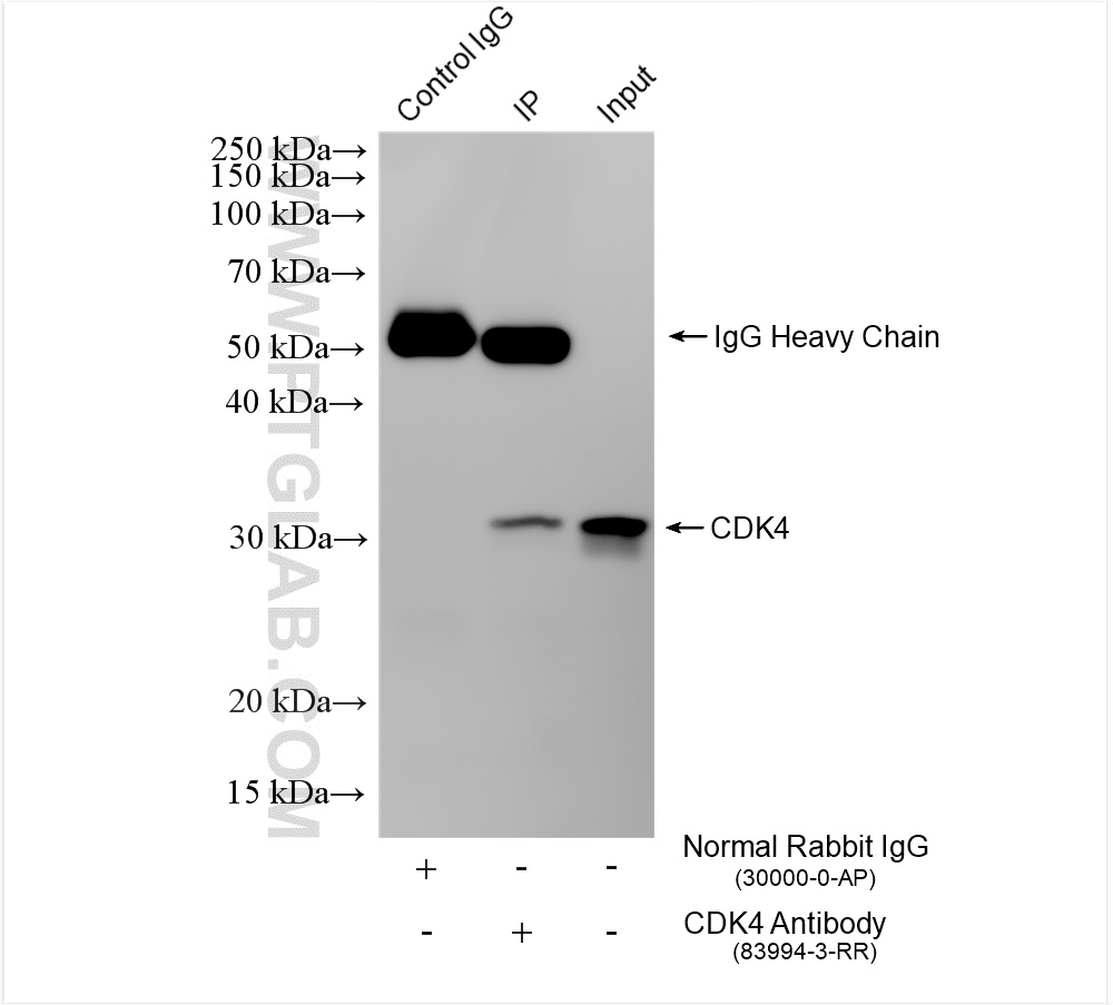 CDK4