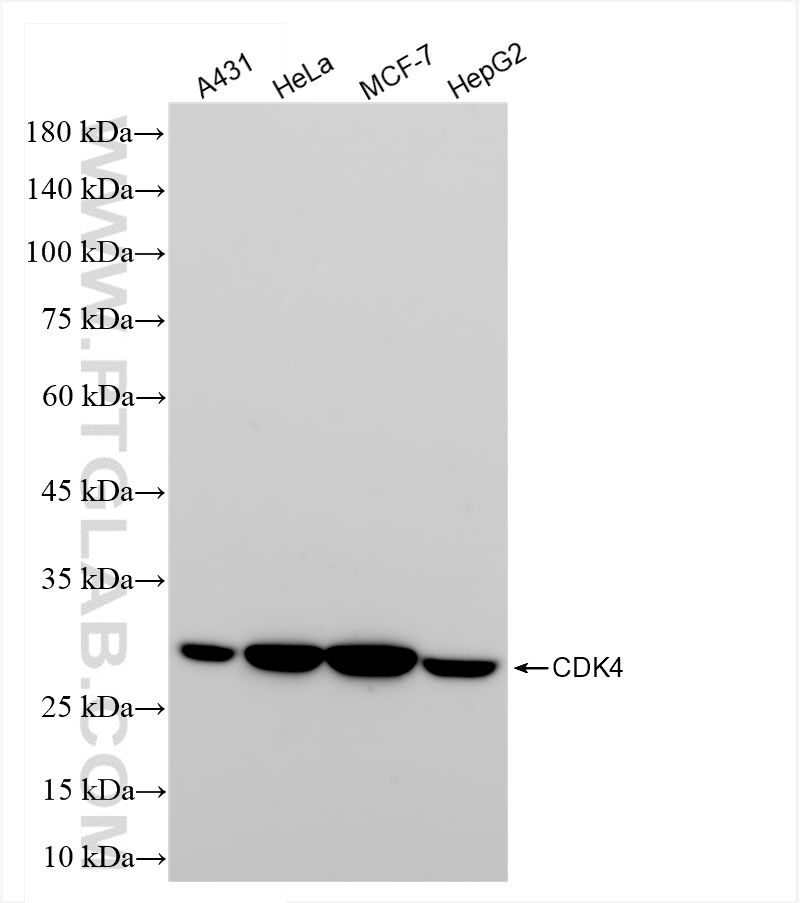 Western Blot (WB) analysis of various lysates using CDK4 Recombinant antibody (83994-3-RR)