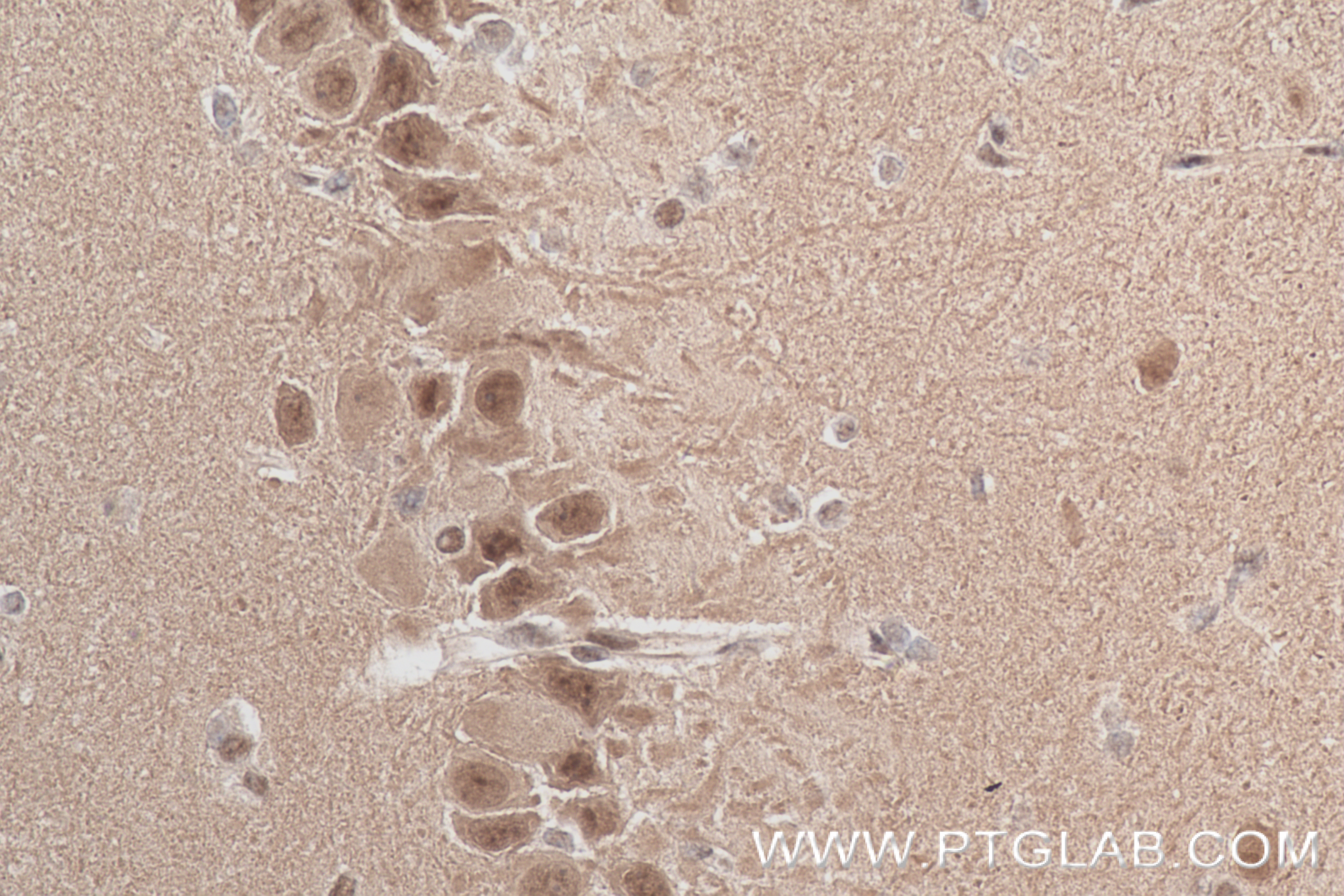 Immunohistochemistry (IHC) staining of rat brain tissue using CDK5 Recombinant antibody (84749-1-RR)