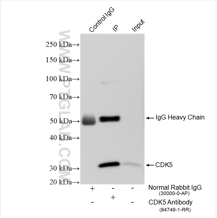 Immunoprecipitation (IP) experiment of mouse brain tissue using CDK5 Recombinant antibody (84749-1-RR)