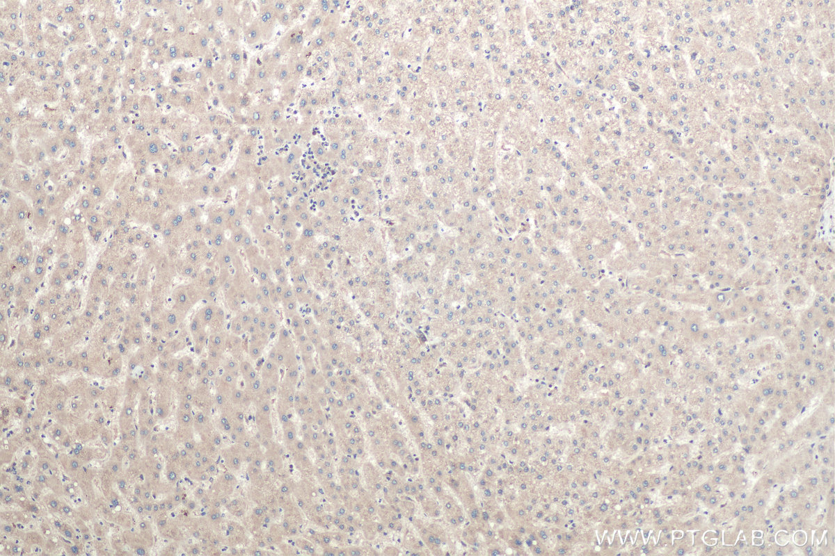 Immunohistochemistry (IHC) staining of human liver tissue using CDK5RAP3 Polyclonal antibody (11007-1-AP)