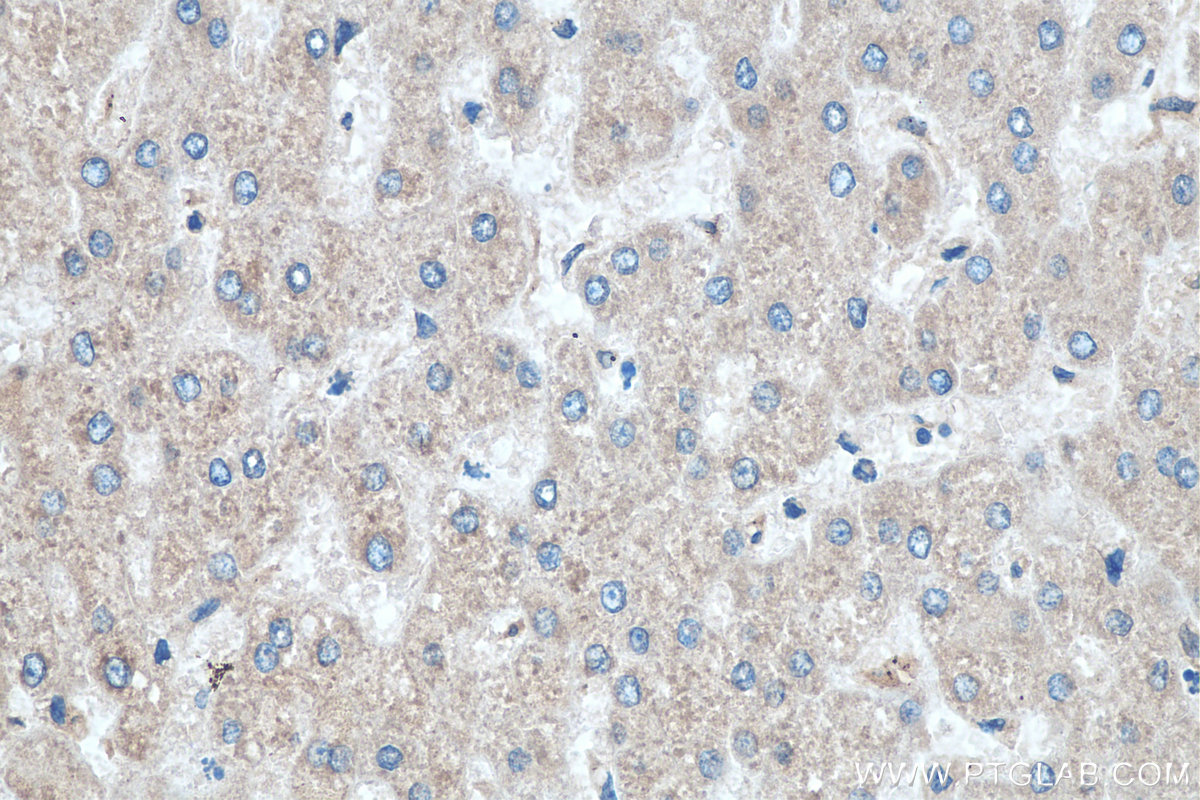 Immunohistochemistry (IHC) staining of human liver tissue using CDK5RAP3 Polyclonal antibody (11007-1-AP)