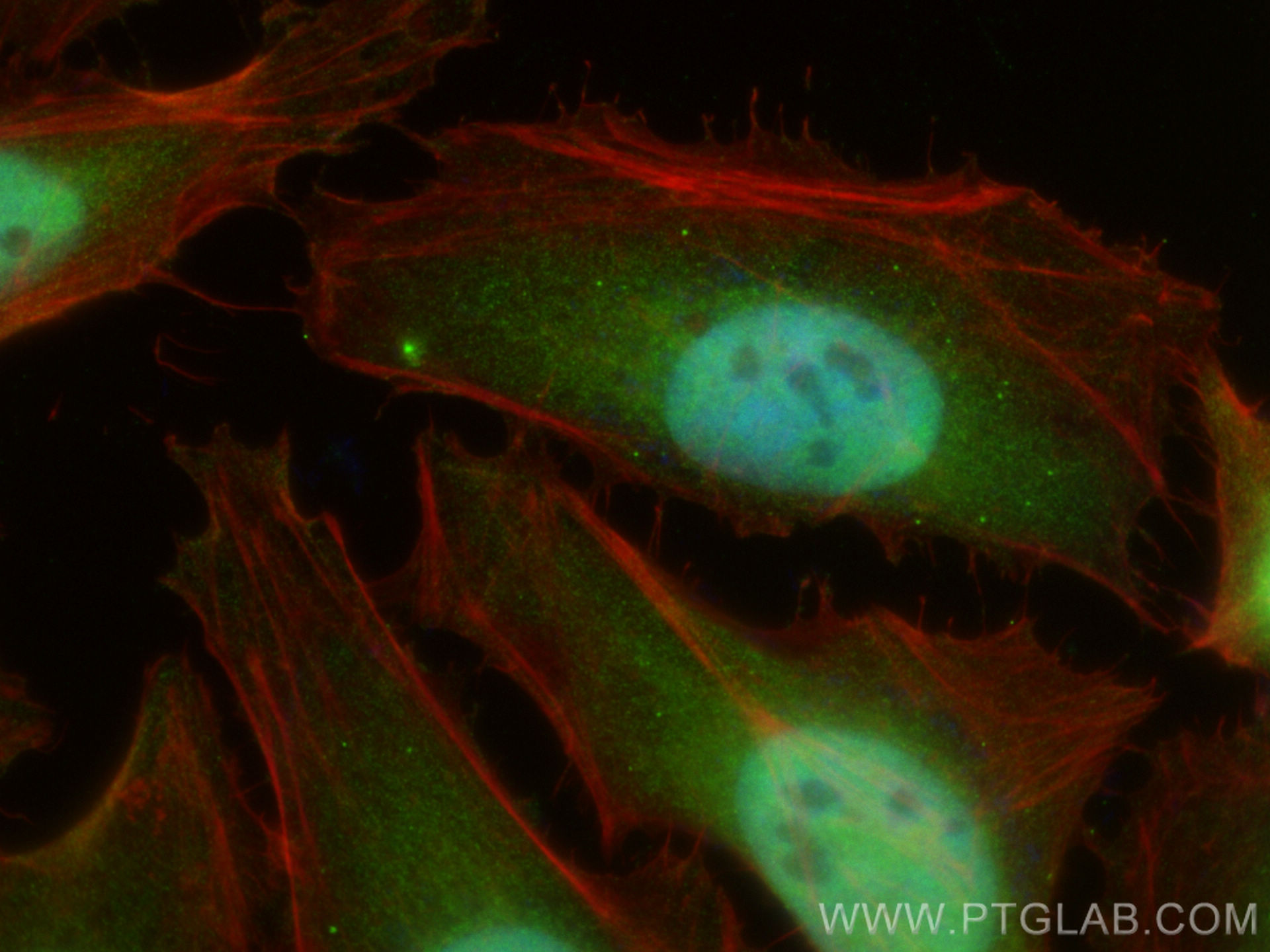 Immunofluorescence (IF) / fluorescent staining of HeLa cells using CDK6 Polyclonal antibody (14052-1-AP)