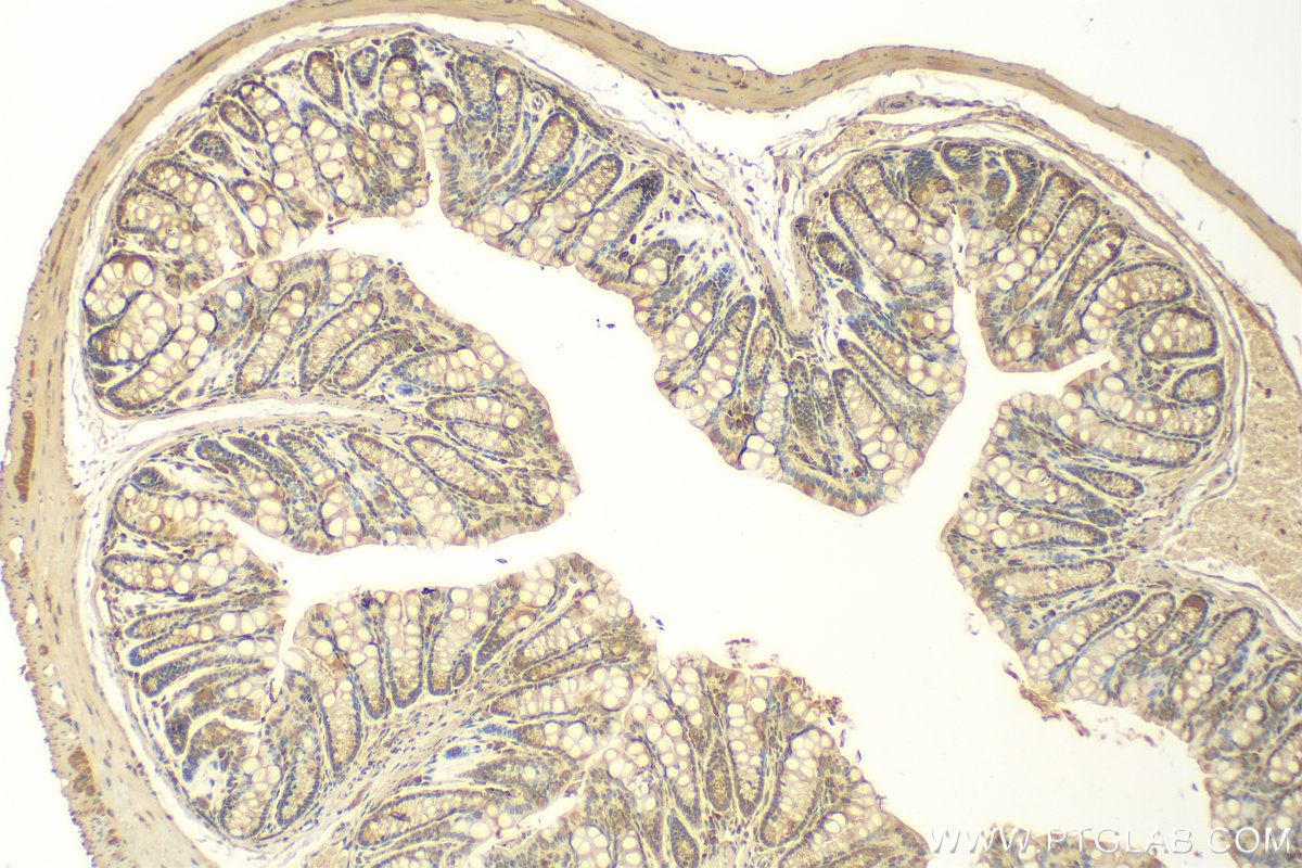 Immunohistochemistry (IHC) staining of mouse colon tissue using CDK6 Polyclonal antibody (14052-1-AP)