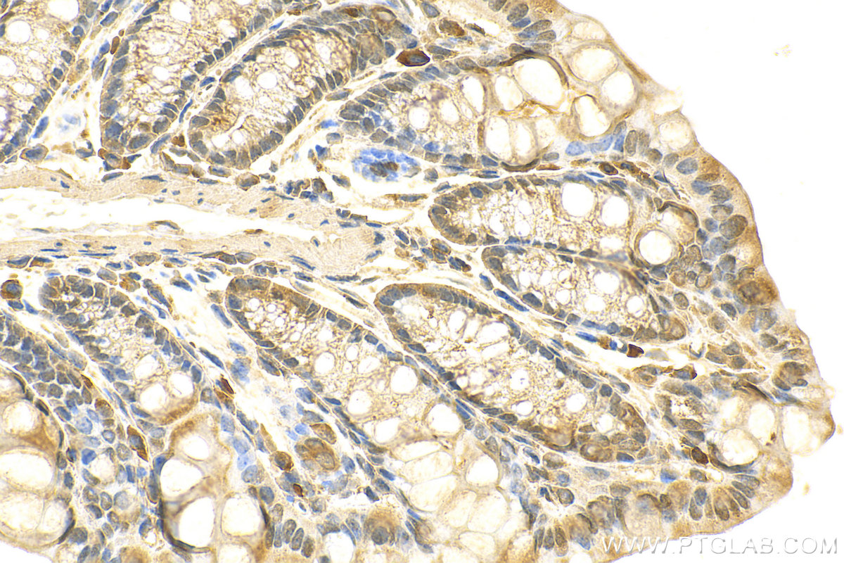 Immunohistochemistry (IHC) staining of mouse colon tissue using CDK6 Polyclonal antibody (14052-1-AP)