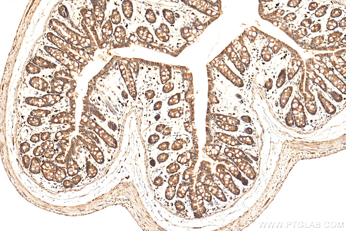 Immunohistochemistry (IHC) staining of mouse colon tissue using CDK6 Polyclonal antibody (14052-1-AP)