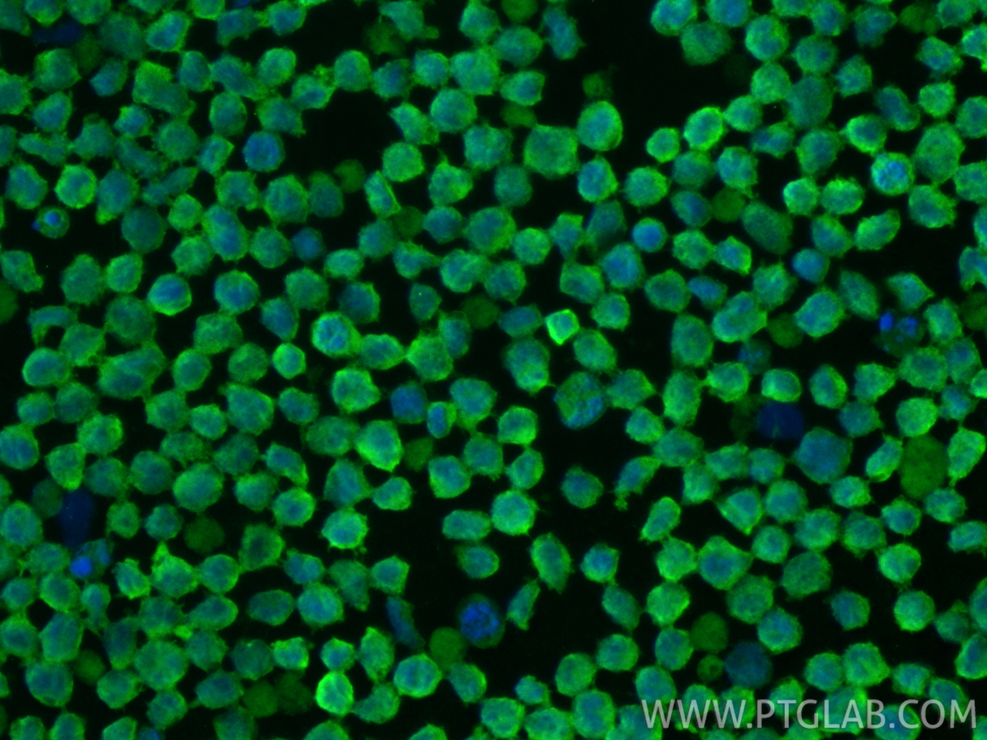 Immunofluorescence (IF) / fluorescent staining of MOLT-4 cells using CDK6 Monoclonal antibody (66278-1-Ig)