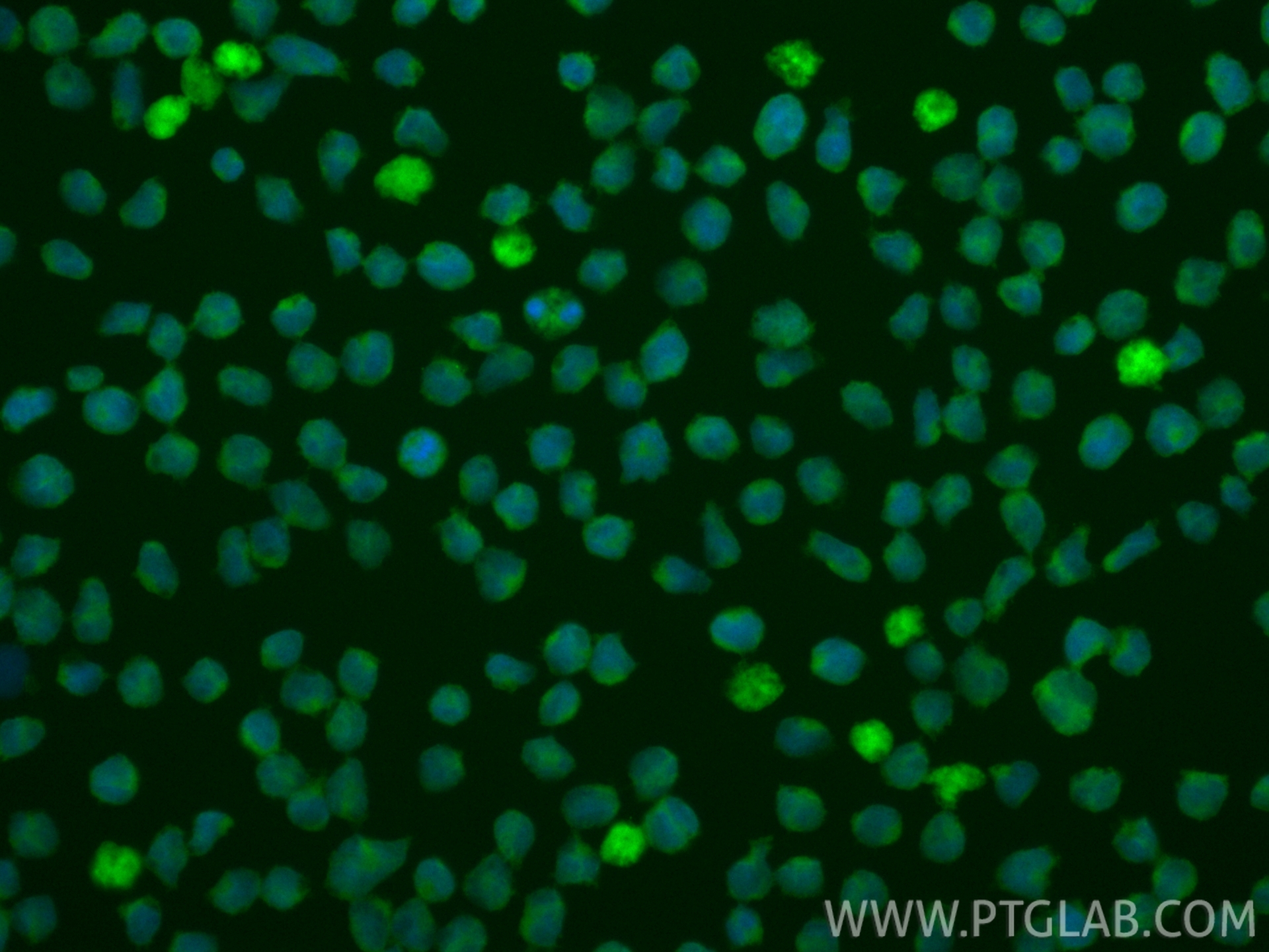 Immunofluorescence (IF) / fluorescent staining of MOLT-4 cells using CoraLite® Plus 488-conjugated CDK6 Monoclonal anti (CL488-66278)