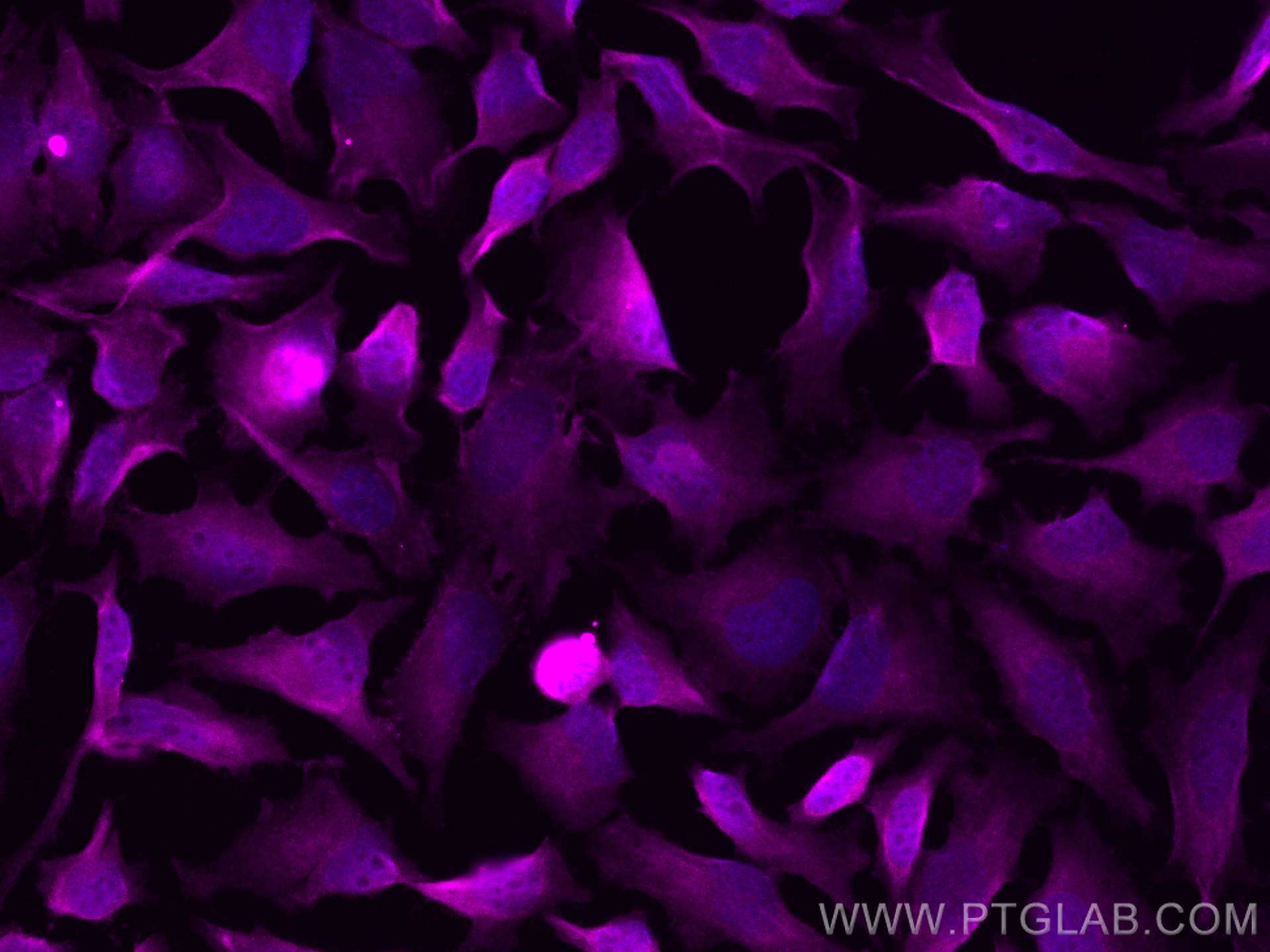Immunofluorescence (IF) / fluorescent staining of HeLa cells using CoraLite® Plus 647-conjugated CDK6 Polyclonal anti (CL647-19117)
