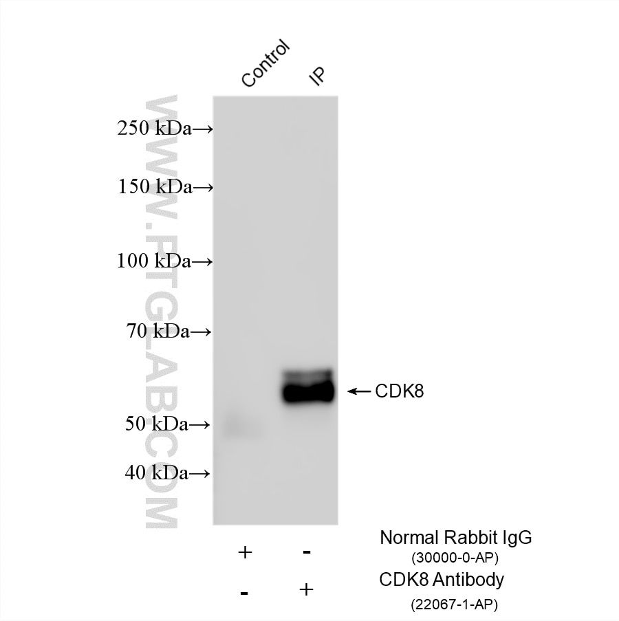 Immunoprecipitation (IP) experiment of HEK-293 cells using CDK8 Polyclonal antibody (22067-1-AP)