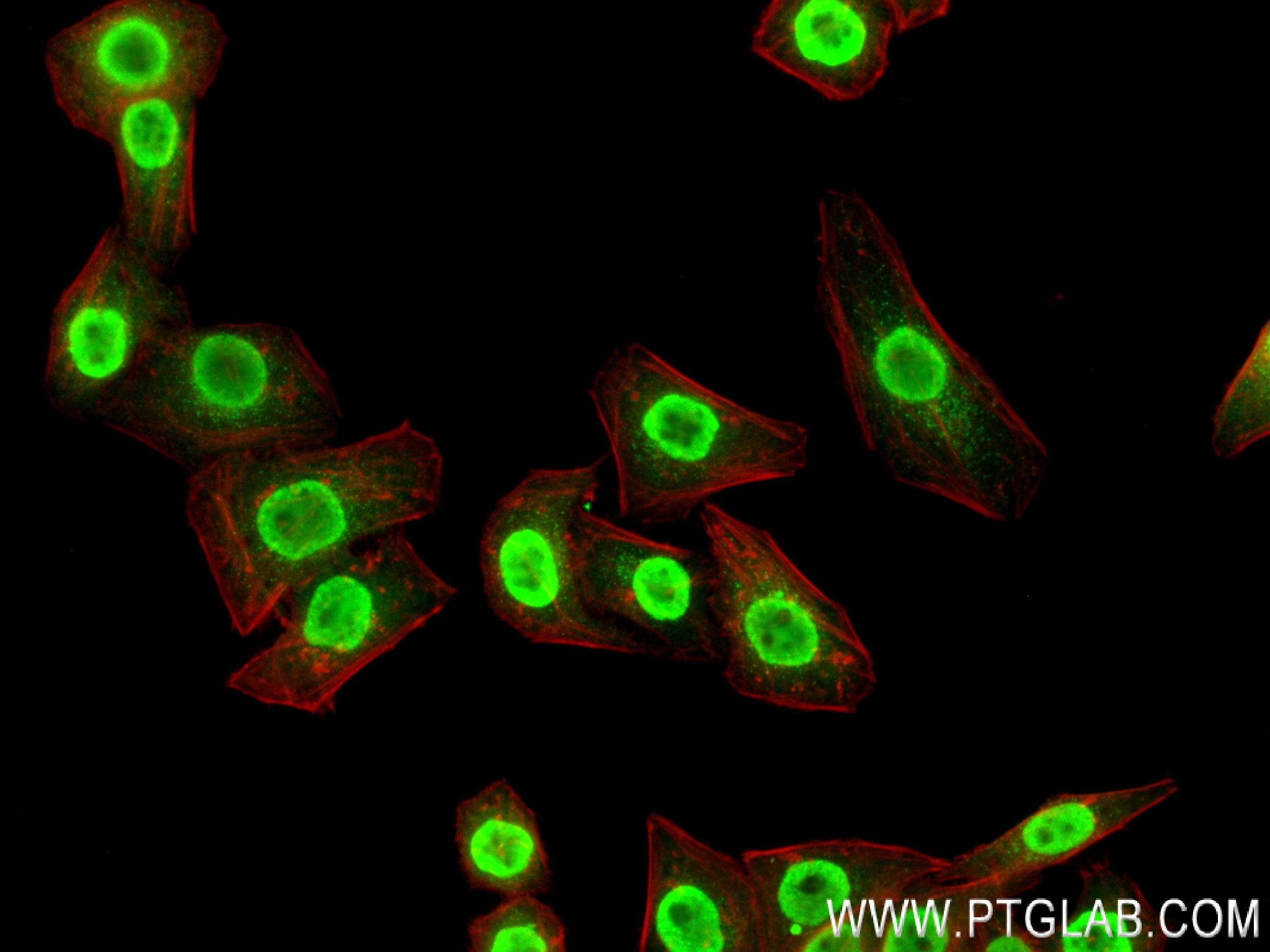 Immunofluorescence (IF) / fluorescent staining of HepG2 cells using CDK8 Recombinant antibody (83621-6-RR)