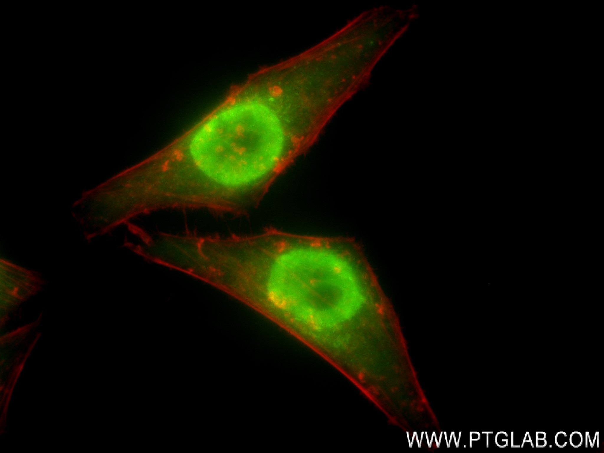 Immunofluorescence (IF) / fluorescent staining of HepG2 cells using CDK8 Recombinant antibody (83621-6-RR)