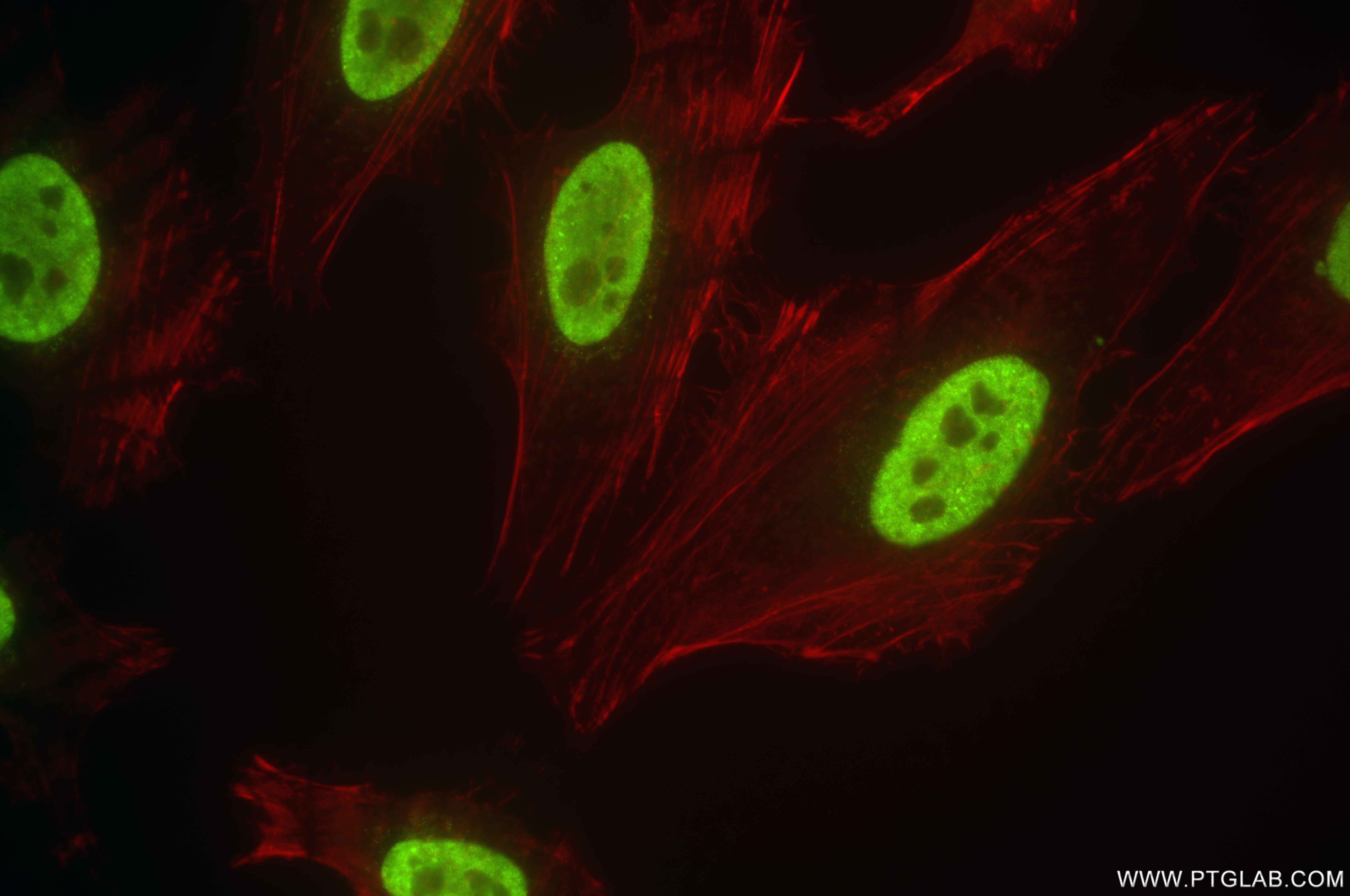 Immunofluorescence (IF) / fluorescent staining of HeLa cells using CDK8 Recombinant antibody (83621-6-RR)