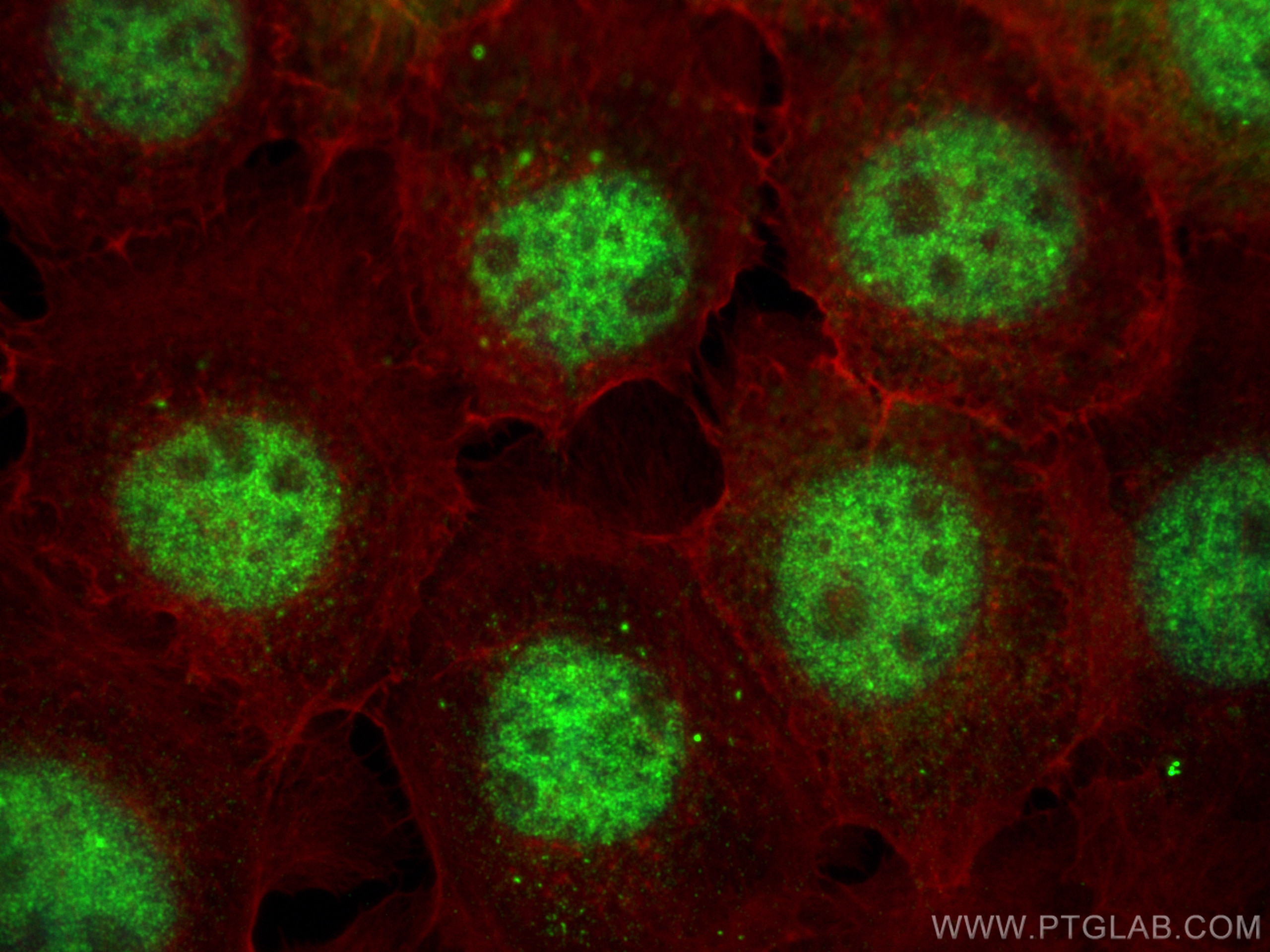 Immunofluorescence (IF) / fluorescent staining of A431 cells using CDK9 Polyclonal antibody (11705-1-AP)