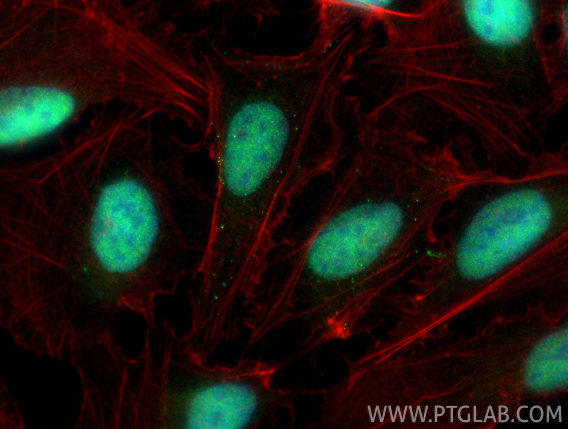 Immunofluorescence (IF) / fluorescent staining of U2OS cells using CDK9 Polyclonal antibody (11705-1-AP)