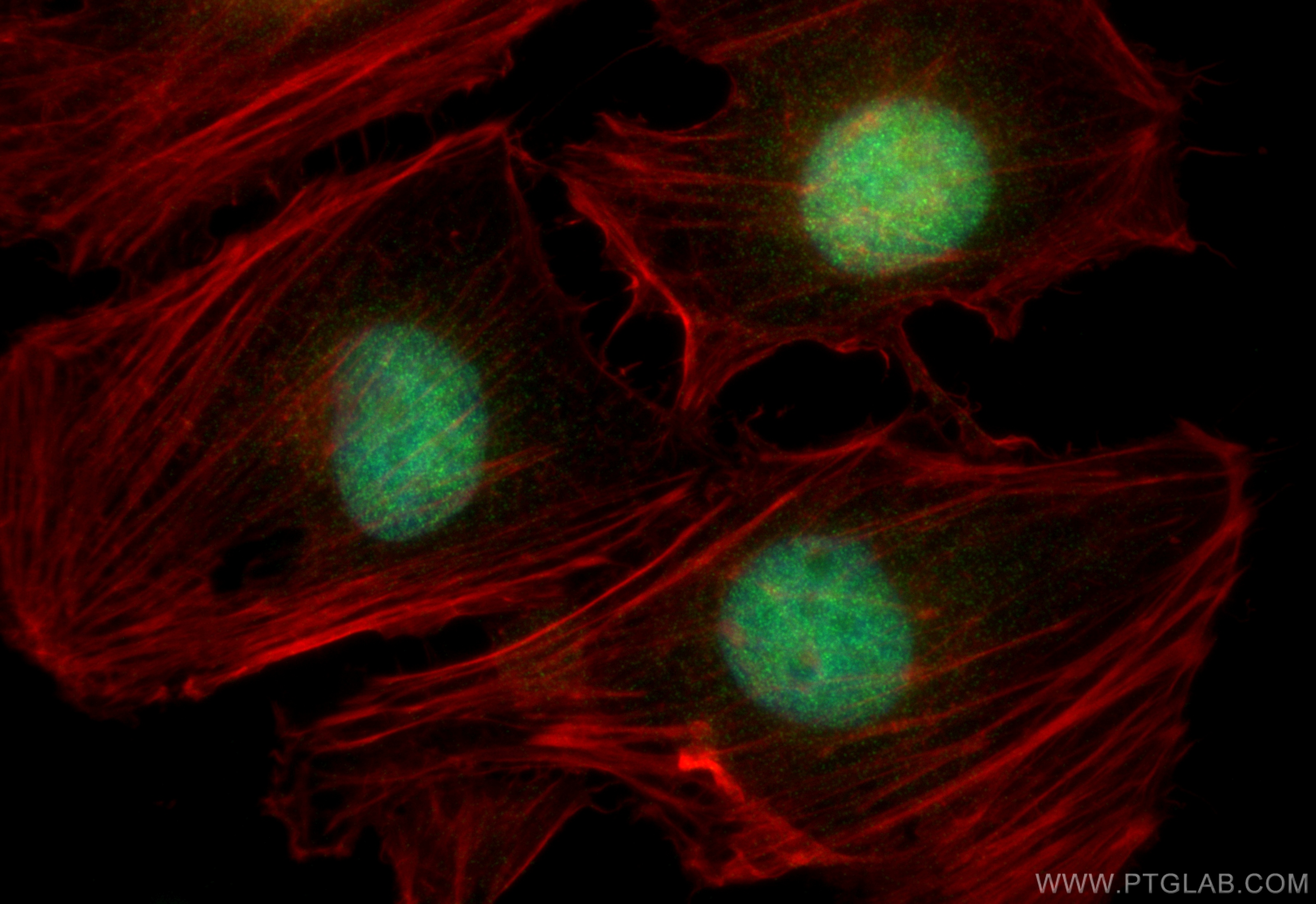 Immunofluorescence (IF) / fluorescent staining of HeLa cells using CDK9 Recombinant antibody (83662-2-RR)