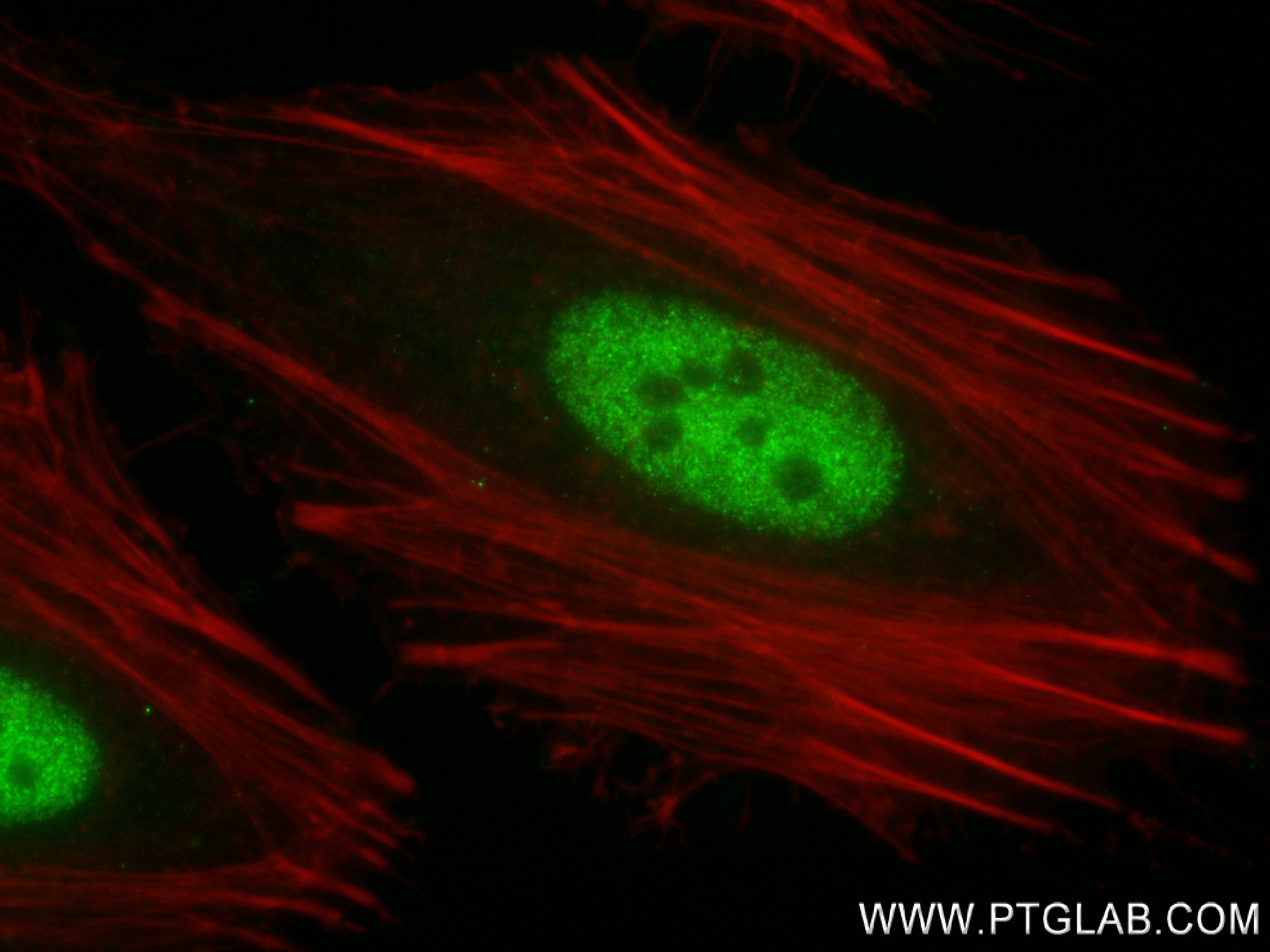 Immunofluorescence (IF) / fluorescent staining of HeLa cells using CDK9 Recombinant antibody (83662-7-RR)