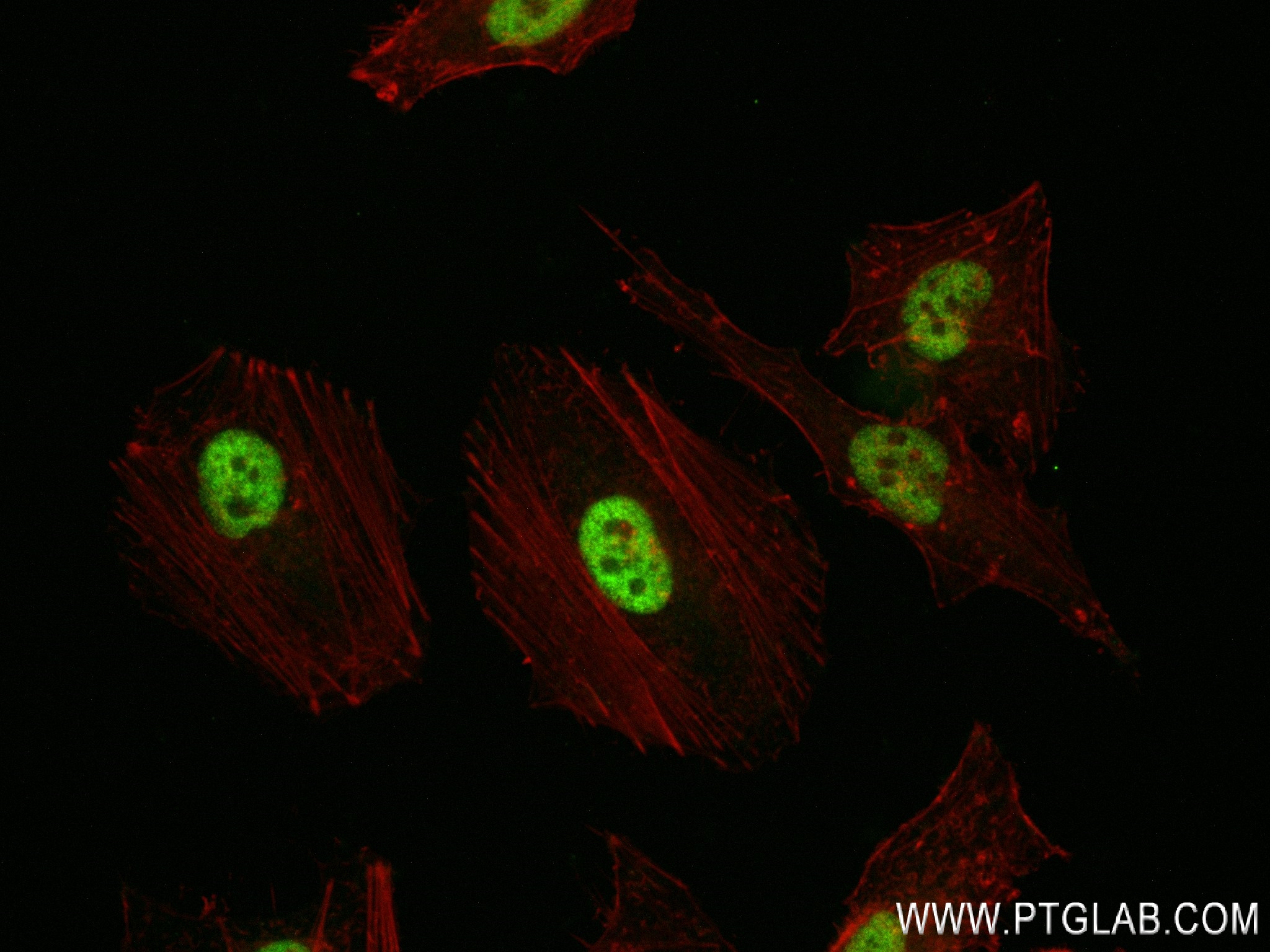 Immunofluorescence (IF) / fluorescent staining of HeLa cells using CDK9 Recombinant antibody (83662-7-RR)