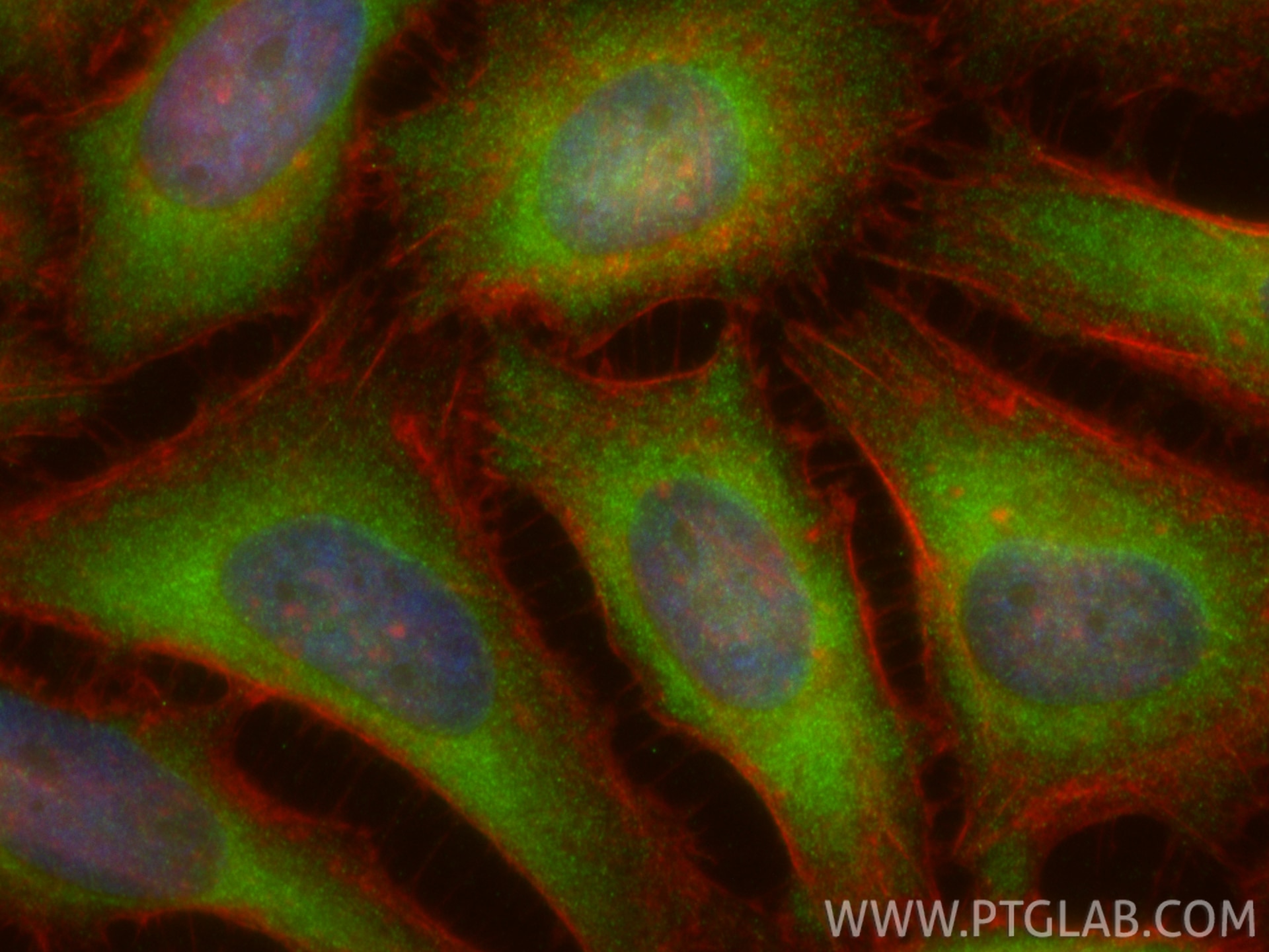 Immunofluorescence (IF) / fluorescent staining of HeLa cells using CDKAL1 Polyclonal antibody (22988-1-AP)