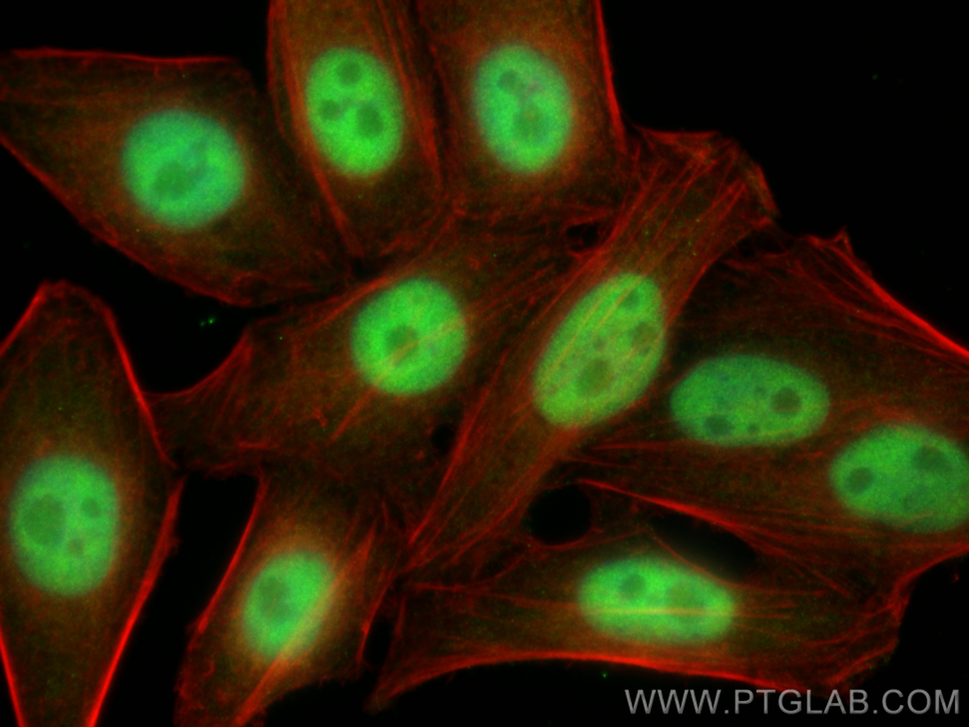 Immunofluorescence (IF) / fluorescent staining of HepG2 cells using CDKN2AIP Polyclonal antibody (16615-1-AP)