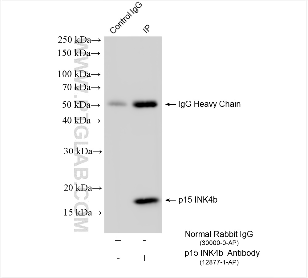 Immunoprecipitation (IP) experiment of HeLa cells using p15 INK4b Polyclonal antibody (12877-1-AP)