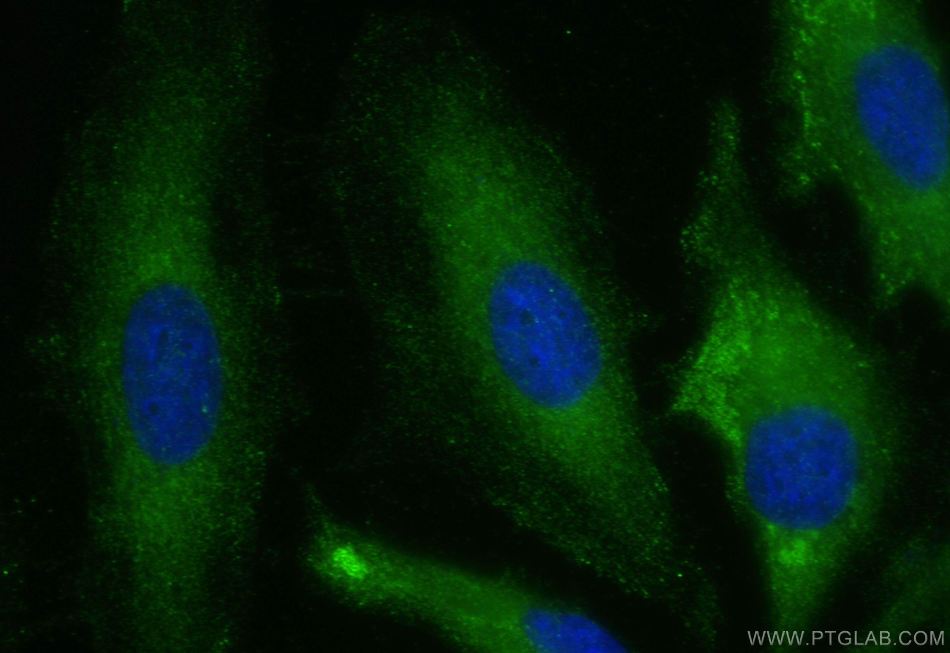 Immunofluorescence (IF) / fluorescent staining of HeLa cells using CDR2L Polyclonal antibody (14563-1-AP)