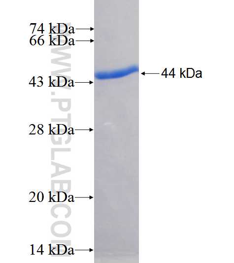 CDV3 fusion protein Ag26577 SDS-PAGE