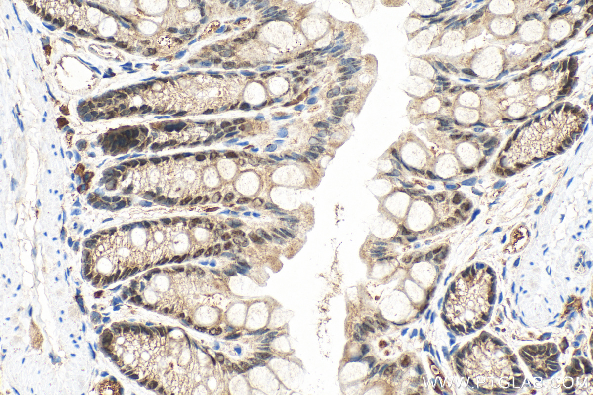 Immunohistochemistry (IHC) staining of mouse colon tissue using CDX1 Polyclonal antibody (21655-1-AP)