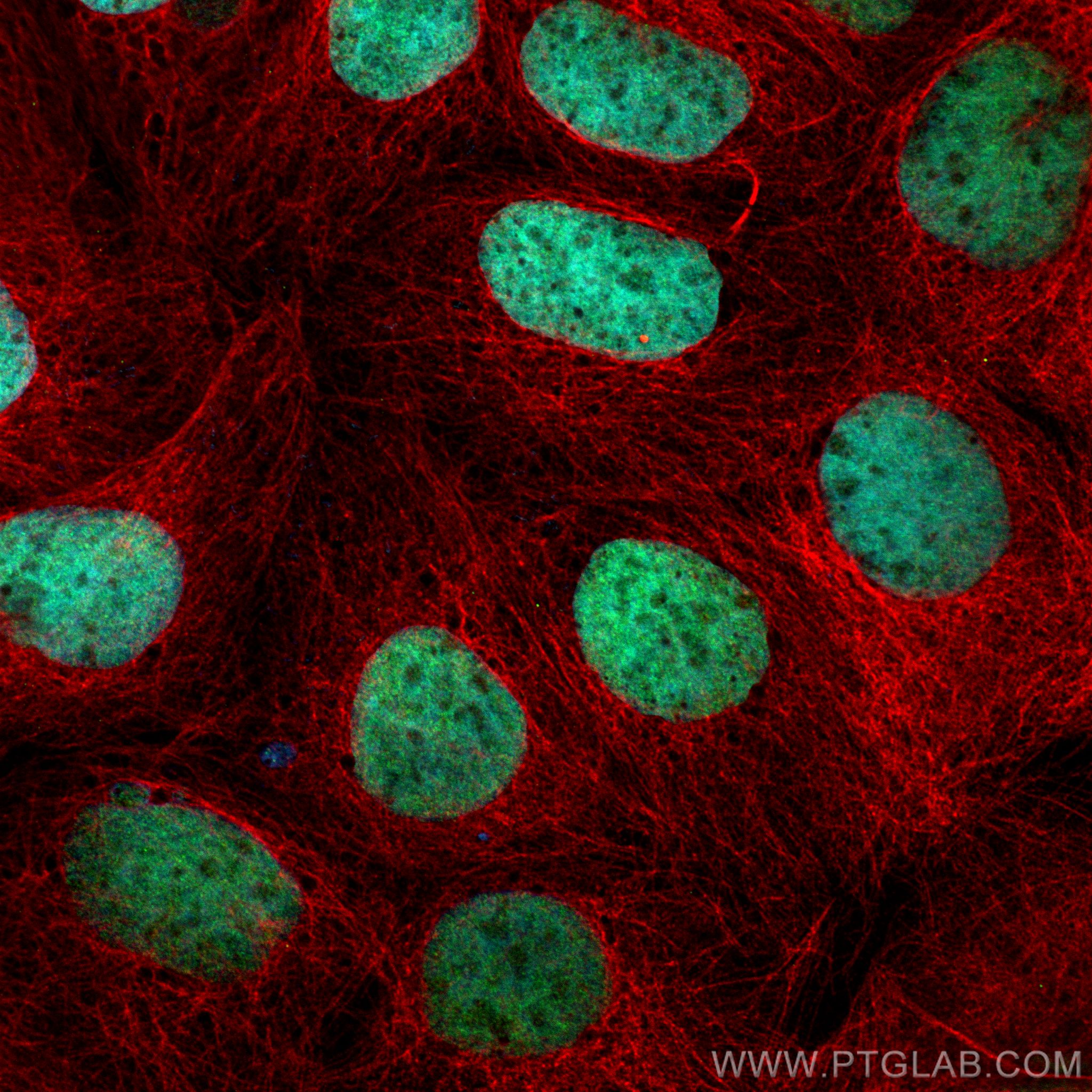 Immunofluorescence (IF) / fluorescent staining of Caco-2 cells using CDX2 Polyclonal antibody (30380-1-AP)