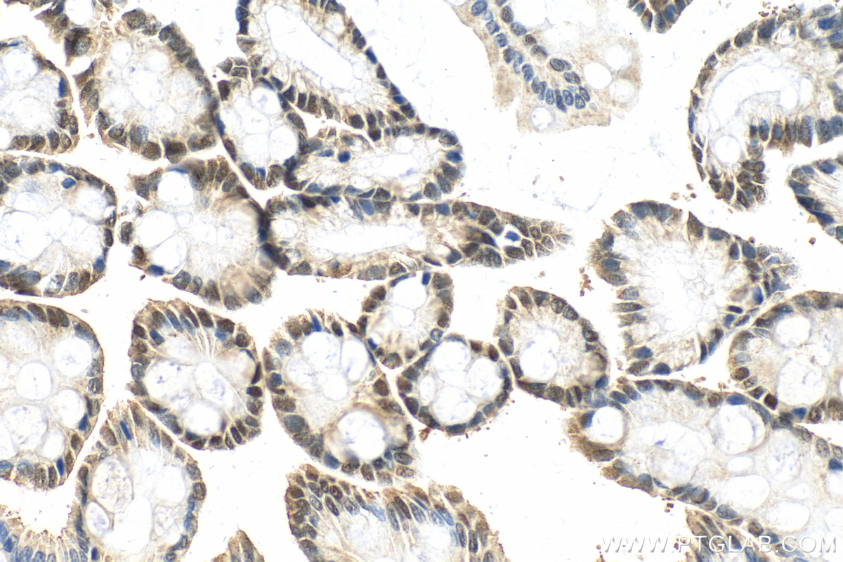 Immunohistochemistry (IHC) staining of rat colon tissue using CDX2 Polyclonal antibody (55286-1-AP)