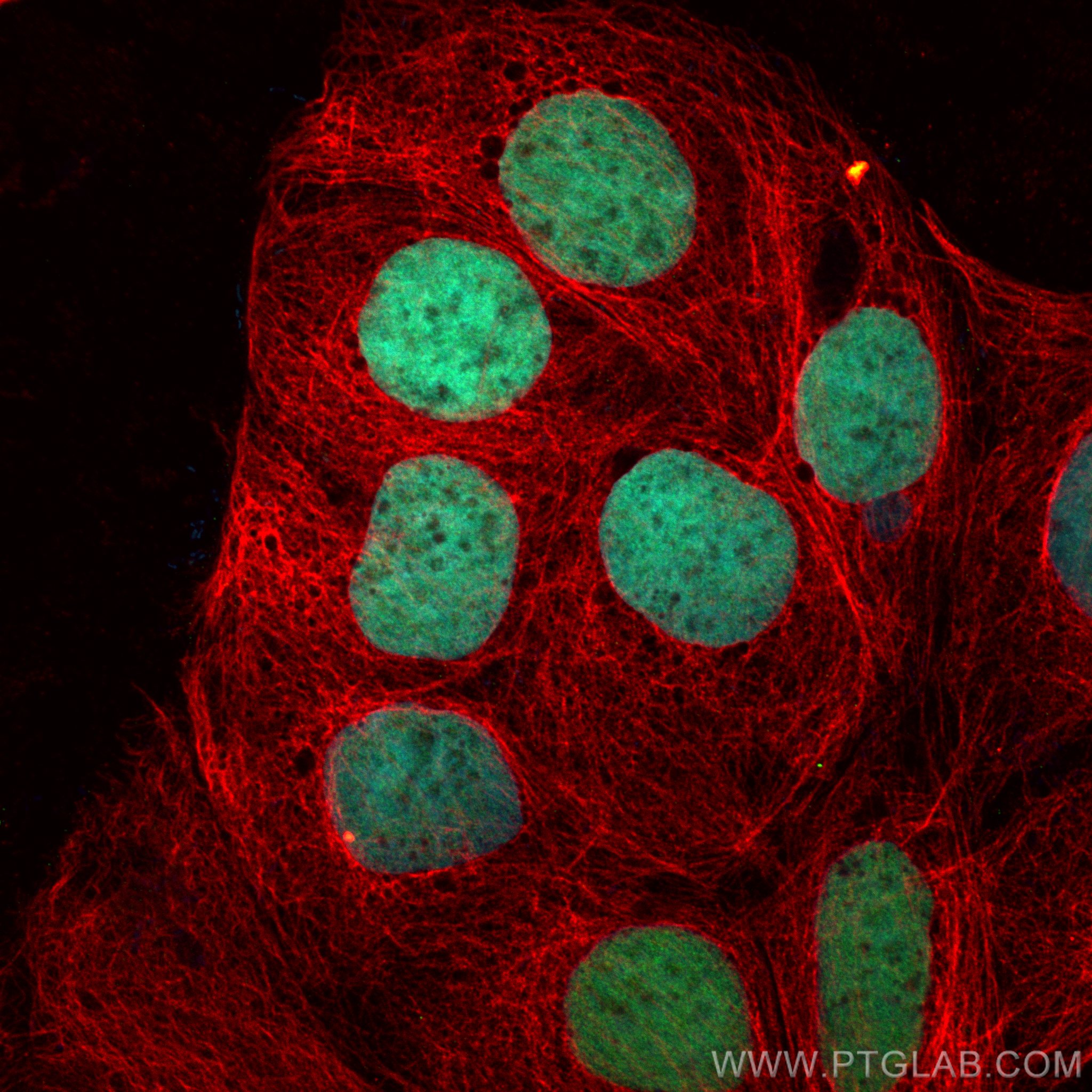 Immunofluorescence (IF) / fluorescent staining of Caco-2 cells using CDX2 Recombinant antibody (82659-1-RR)