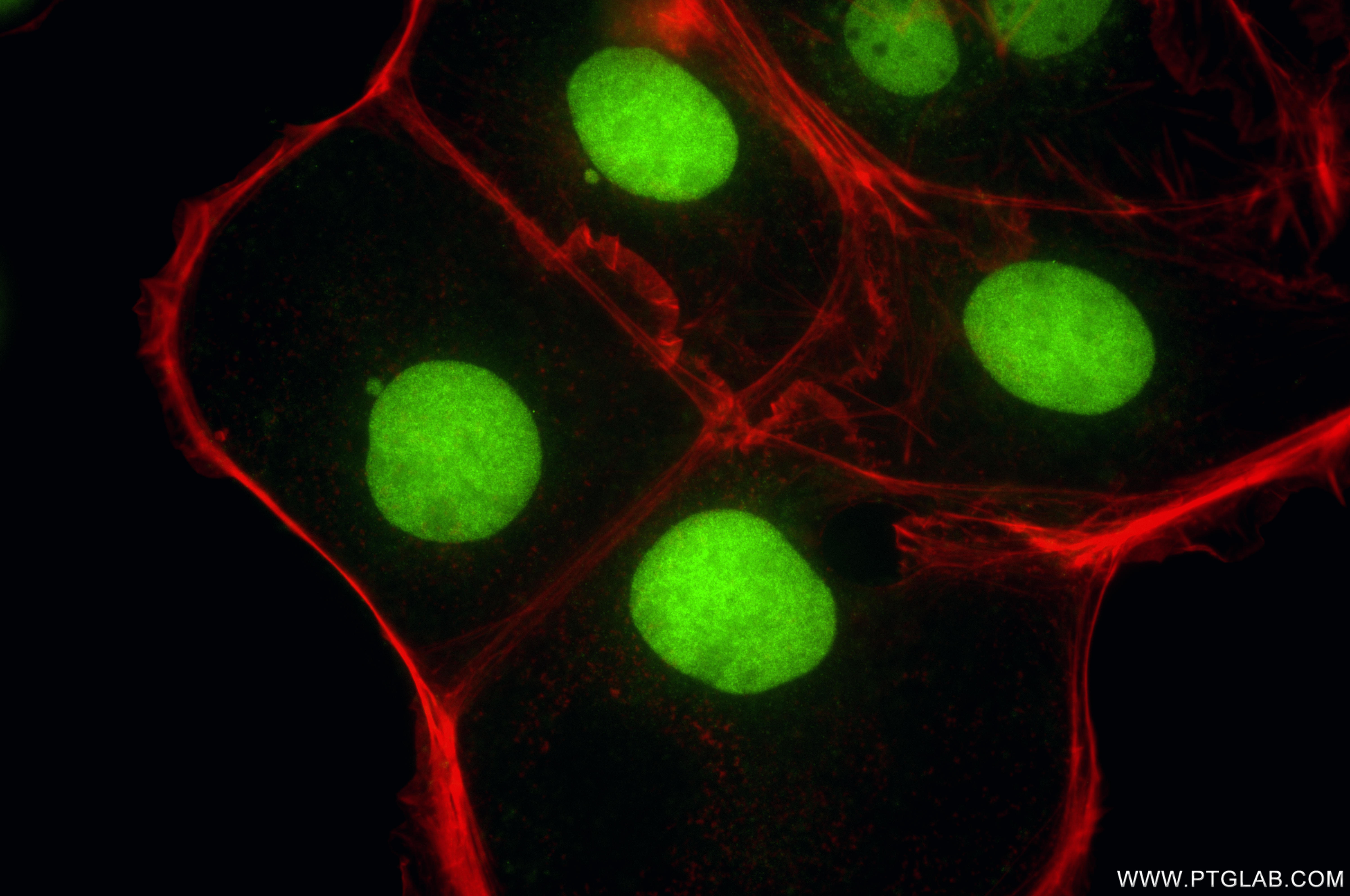 Immunofluorescence (IF) / fluorescent staining of Caco-2 cells using CDX2 Recombinant monoclonal antibody (82659-1-RR)